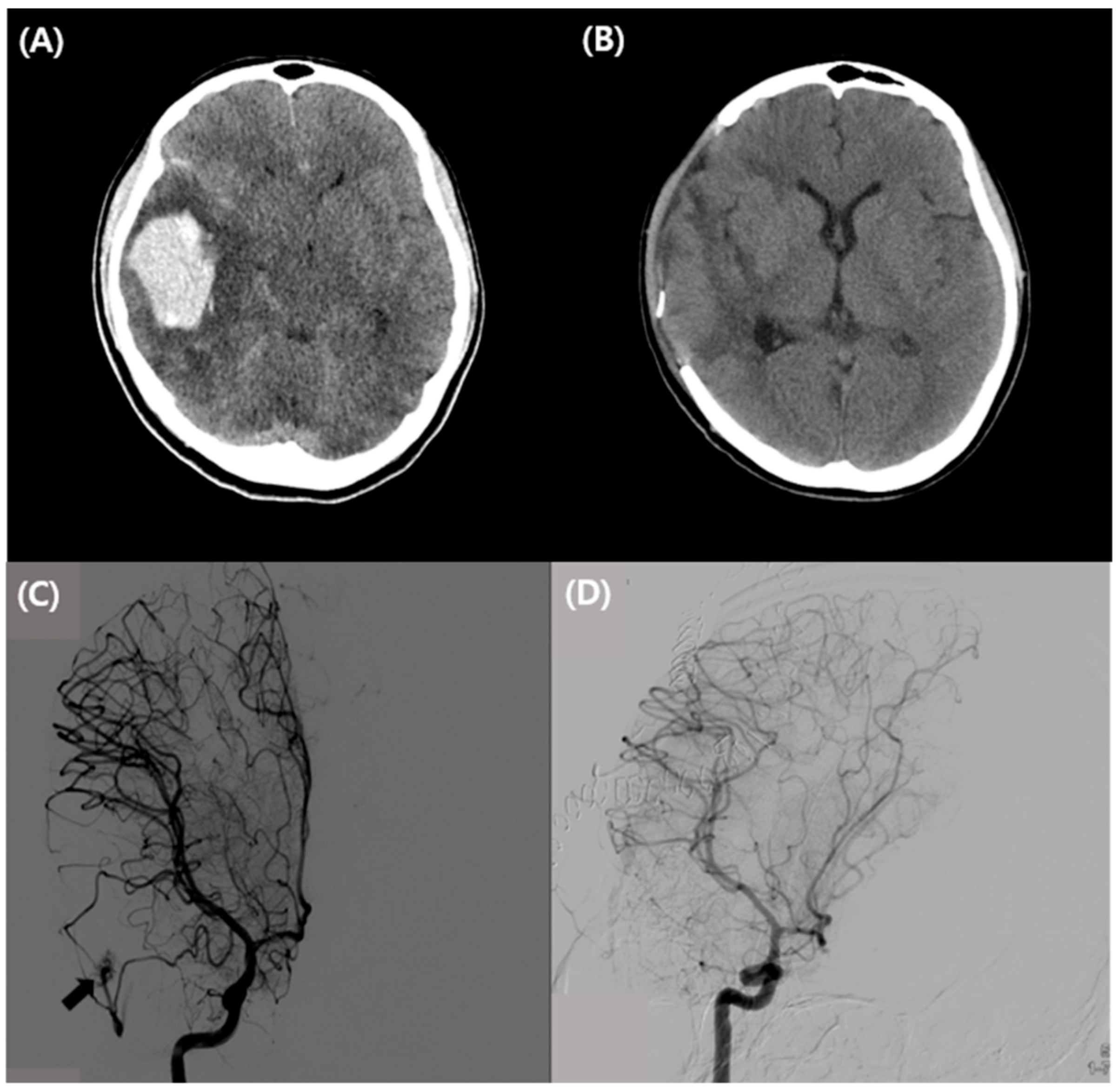 Vaccines 10 00362 g001 550