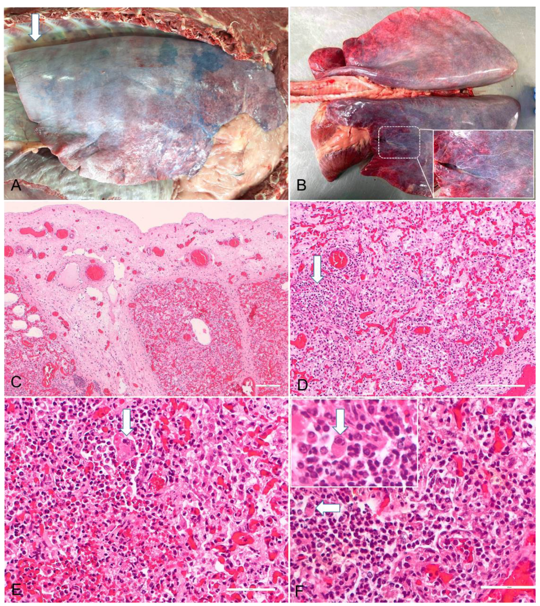 Vaccines 10 00468 g001 Vaccines 10 00468 g001