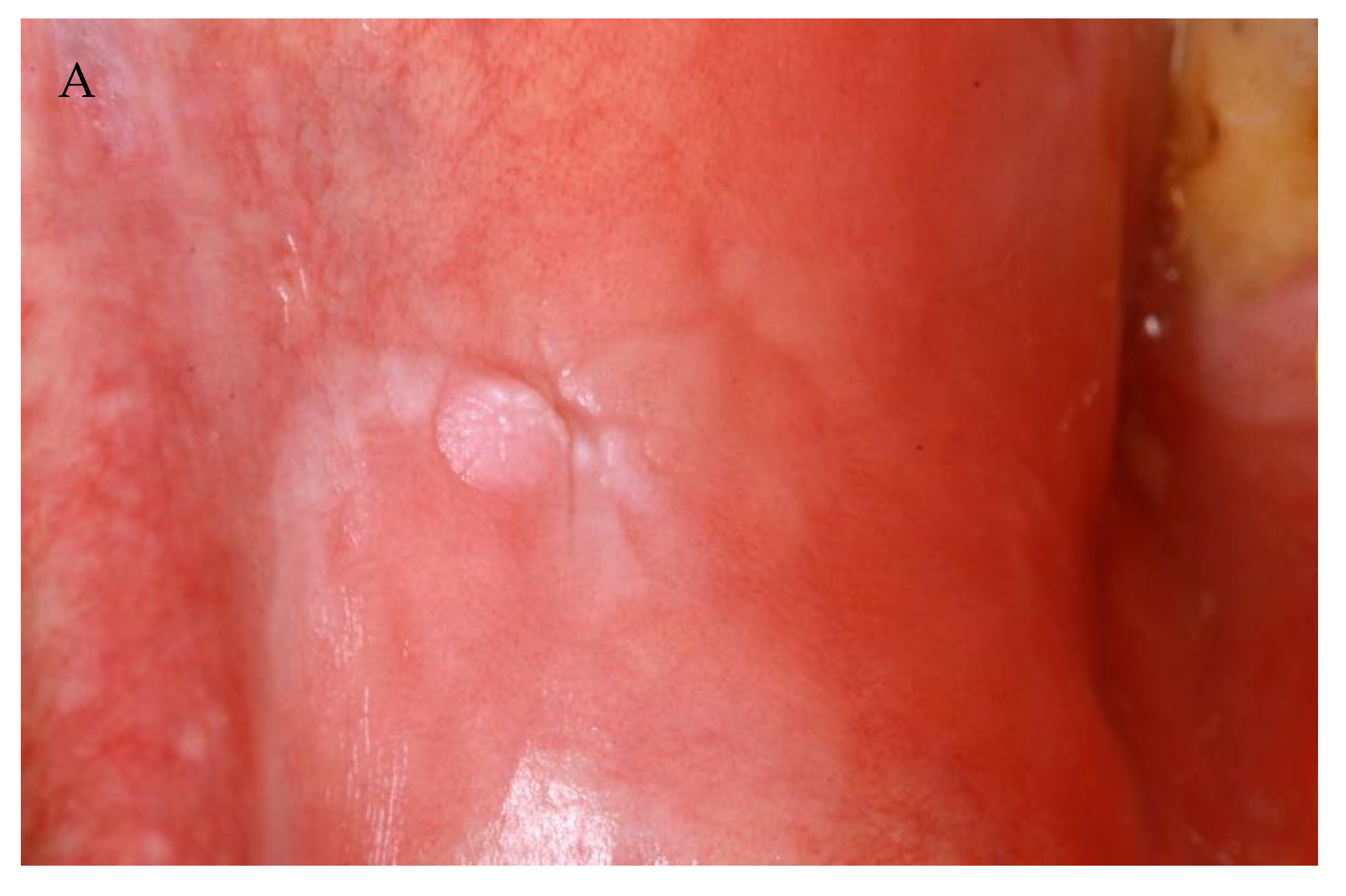 Vaccines 10 00480 g001a