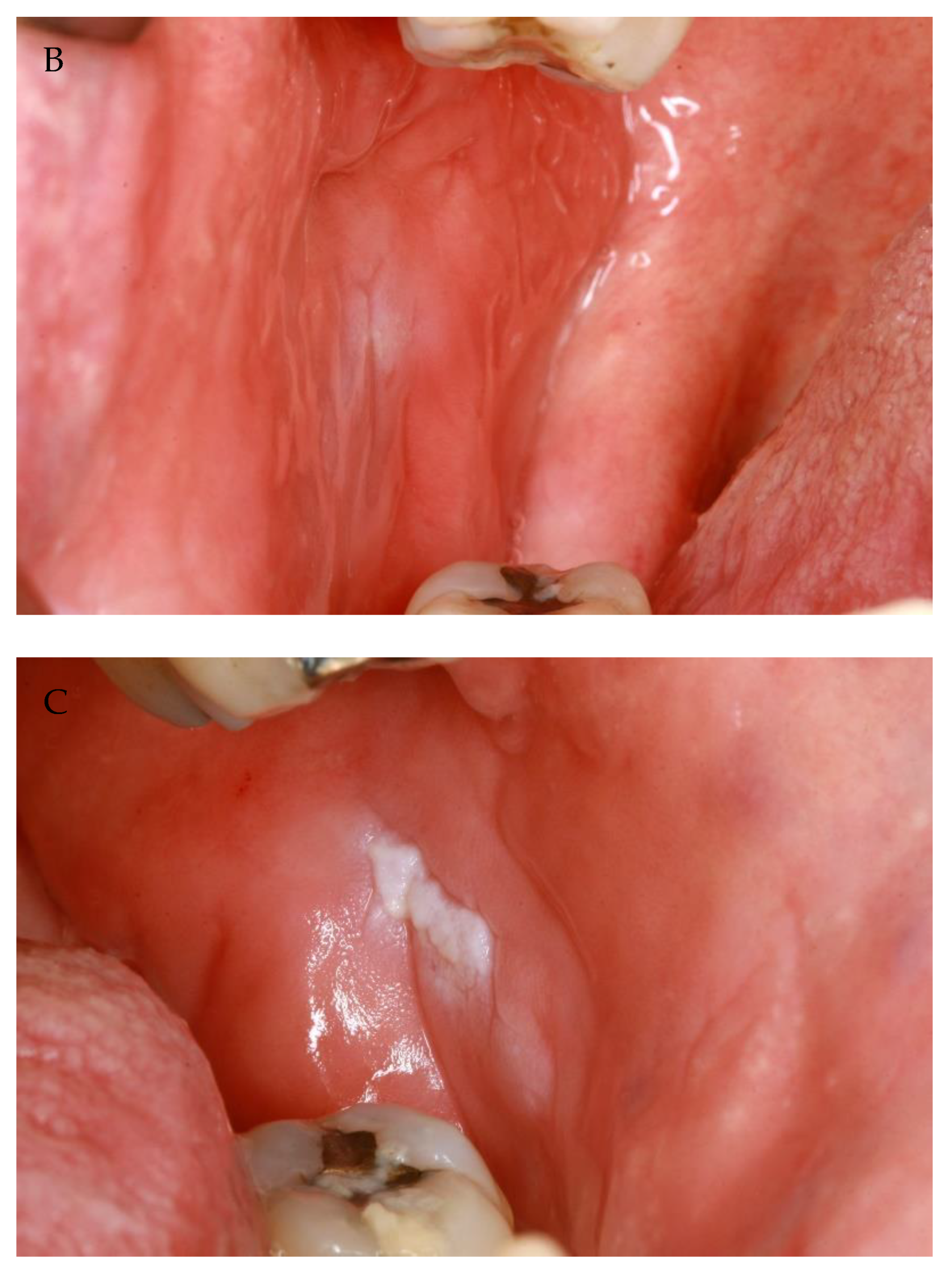 Vaccines 10 00480 g001b