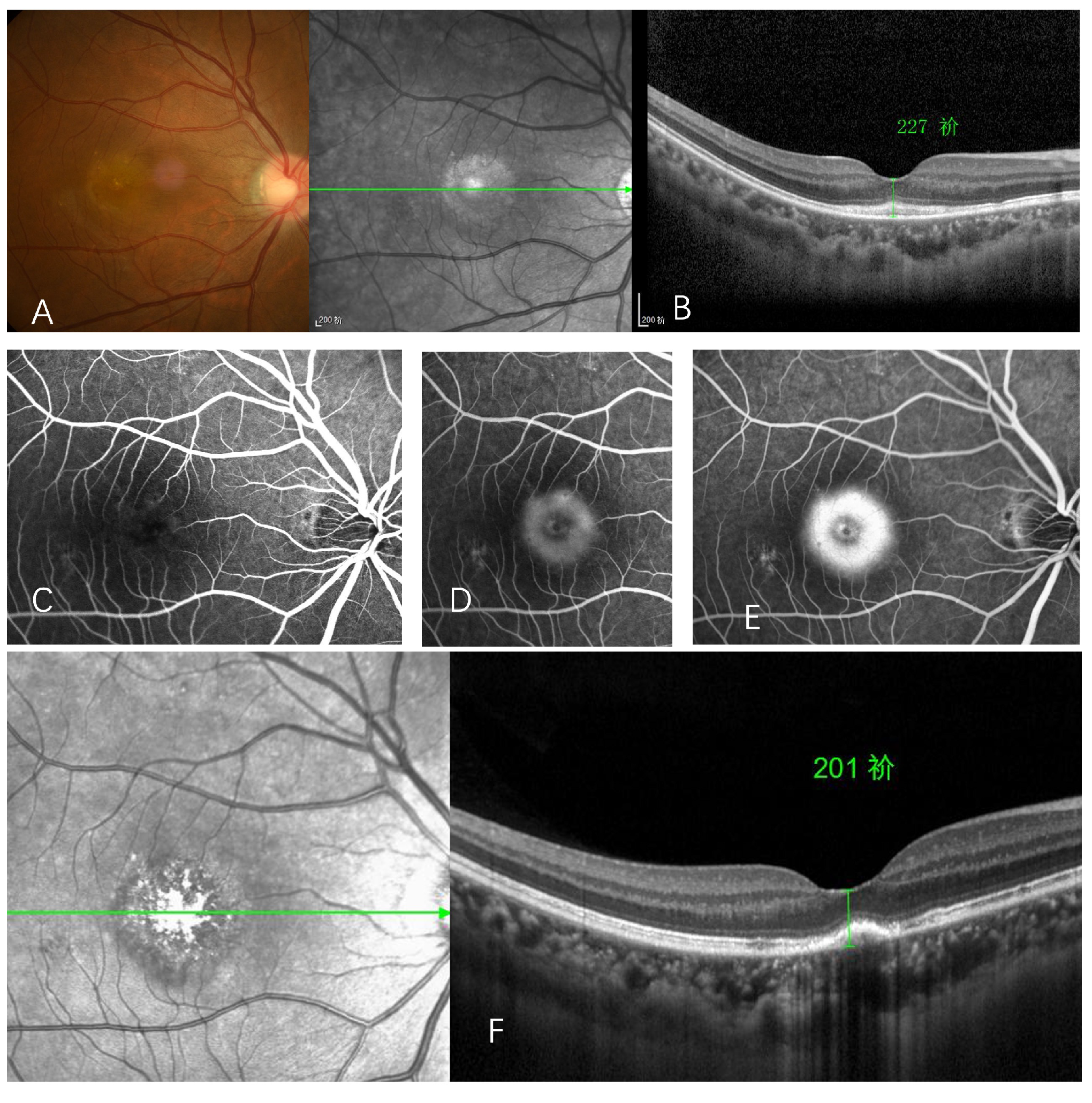 Vaccines 10 00482 g003 550