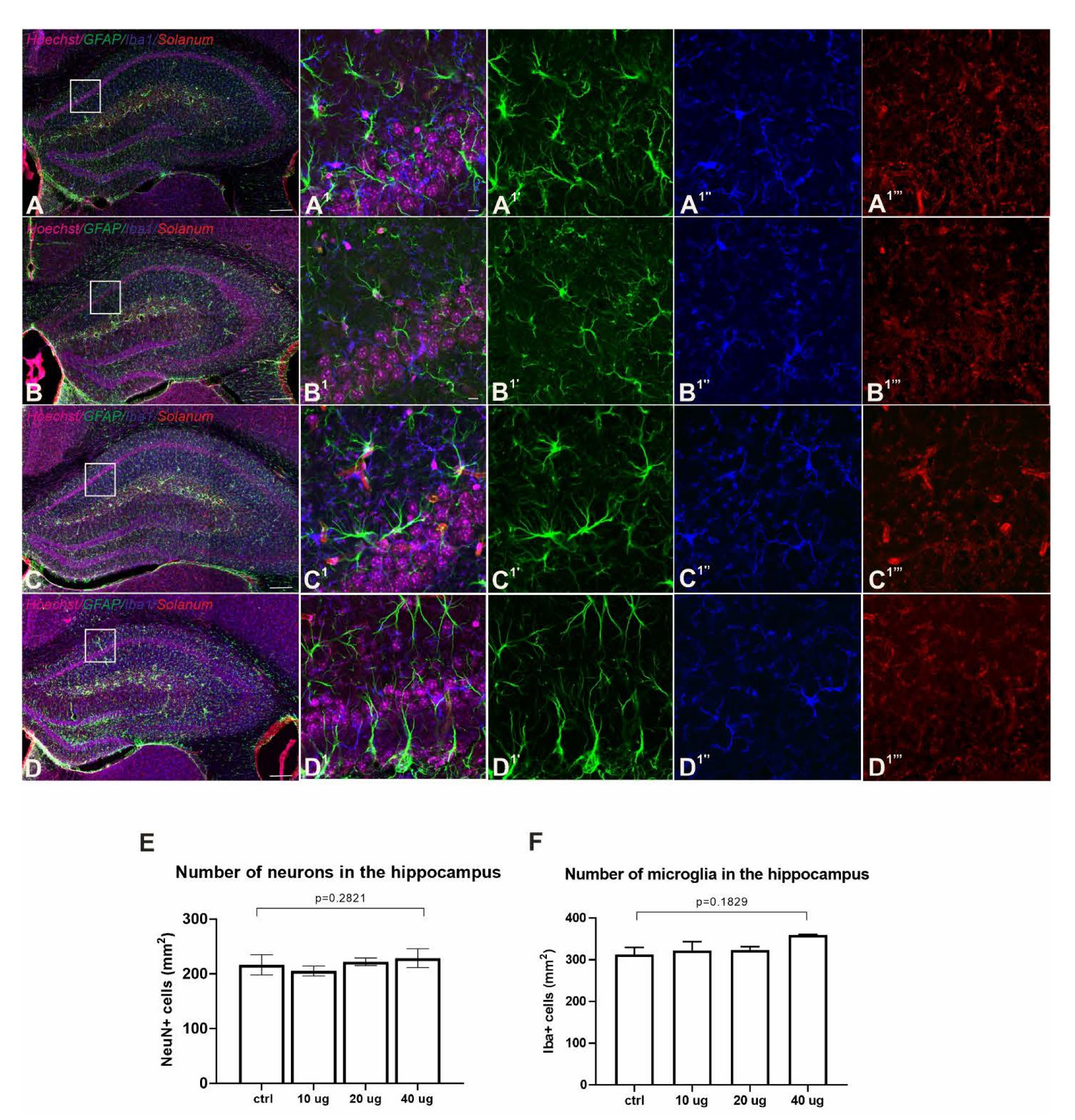 Vaccines 10 00516 g004 550