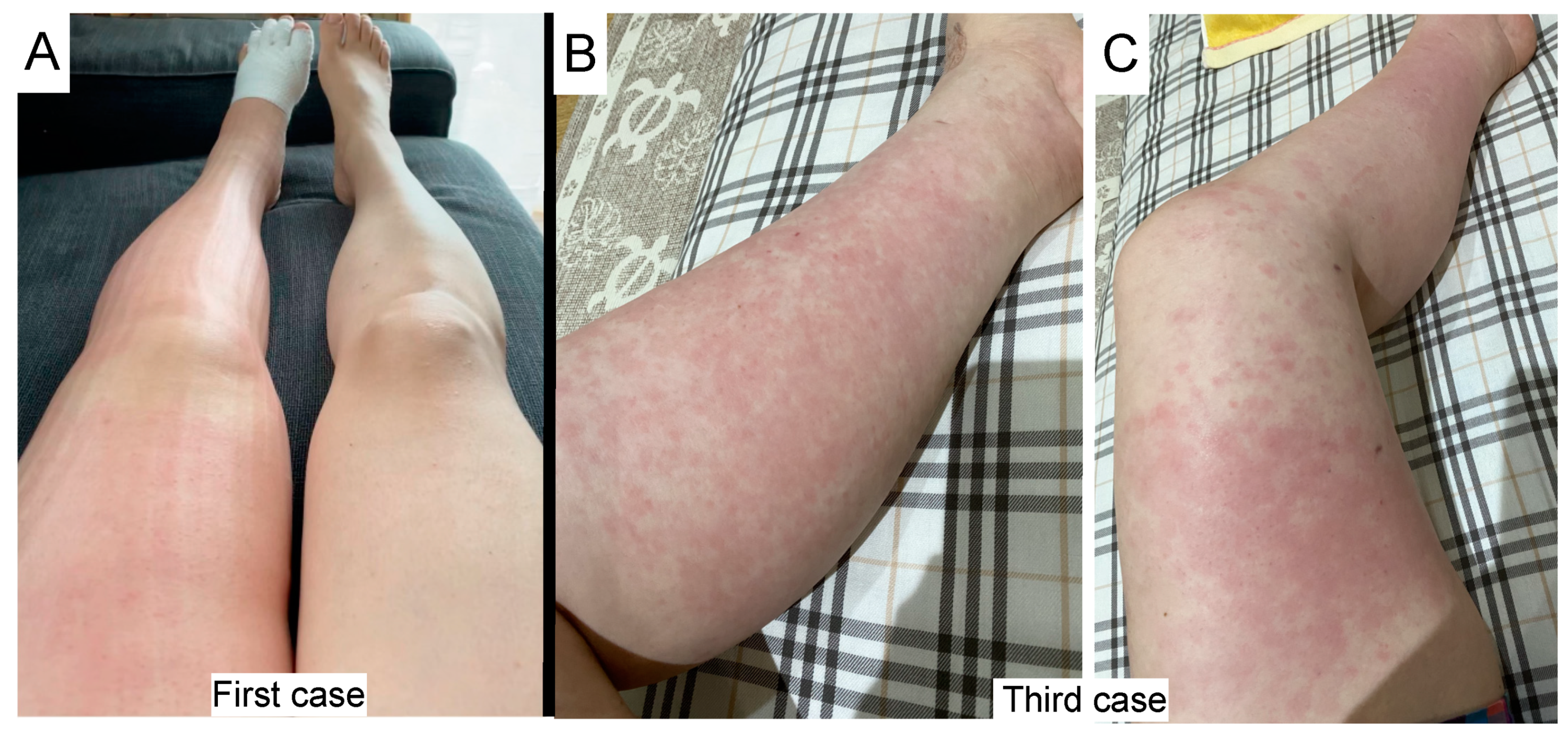 Vaccines 10 00517 g001