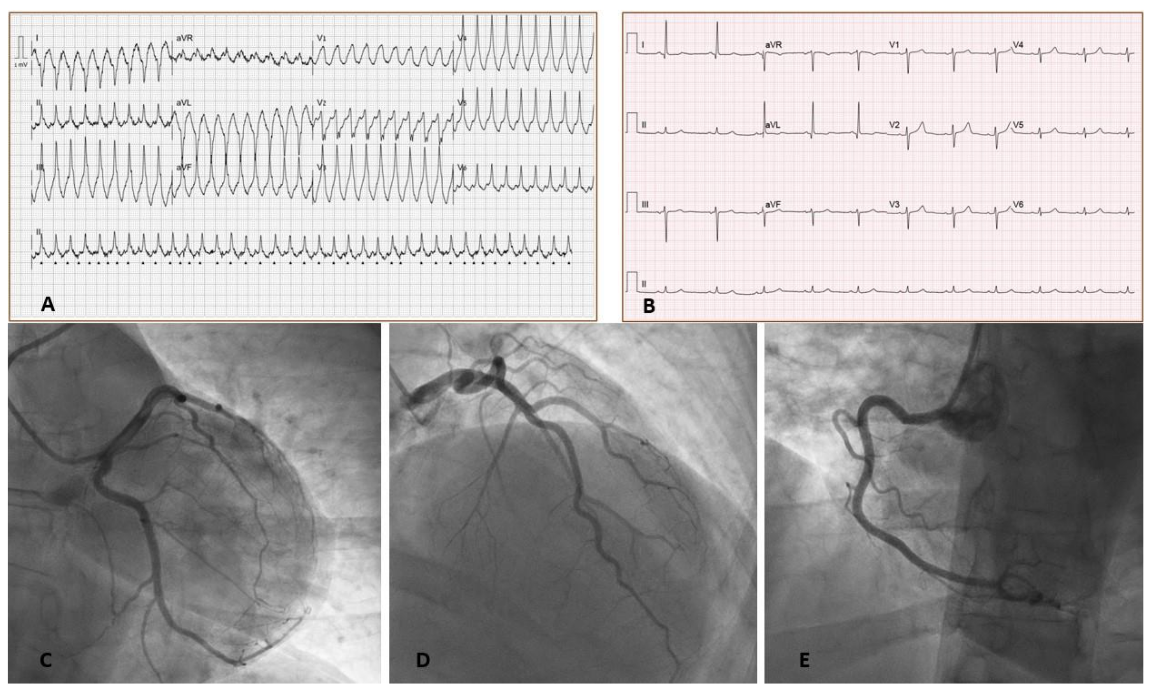 Vaccines 10 00575 g001