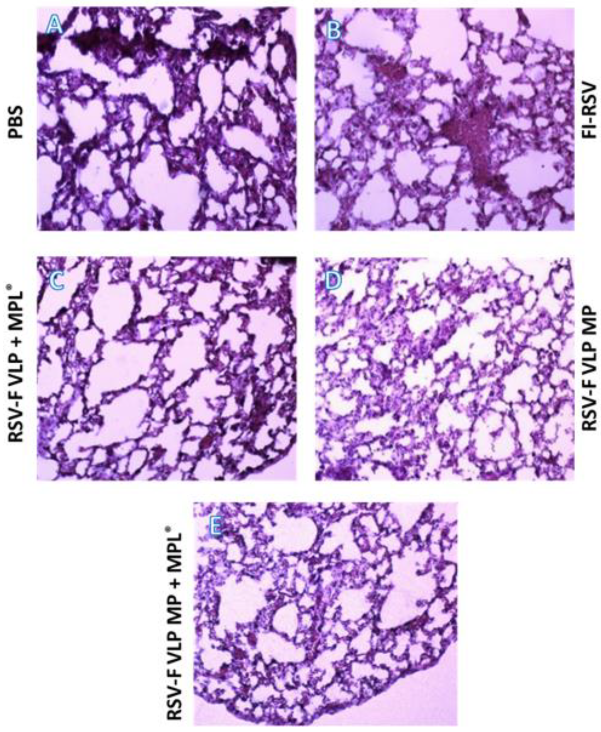 Vaccines 10 00584 g006 550