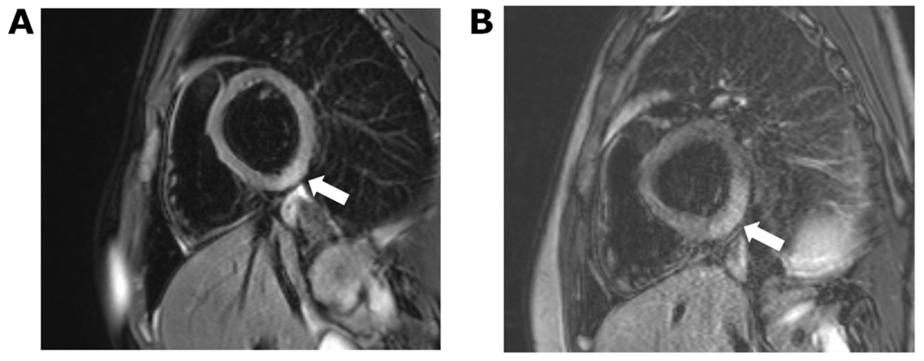 Vaccines 10 00611 g002 550