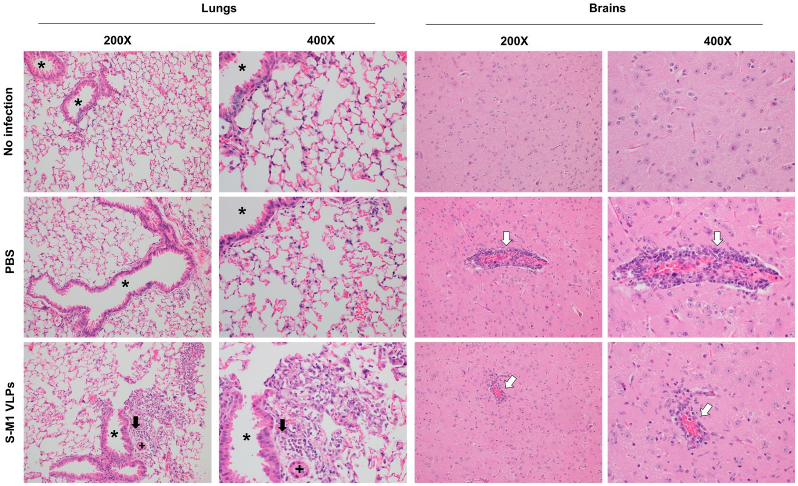 Vaccines 10 00786 g007 550