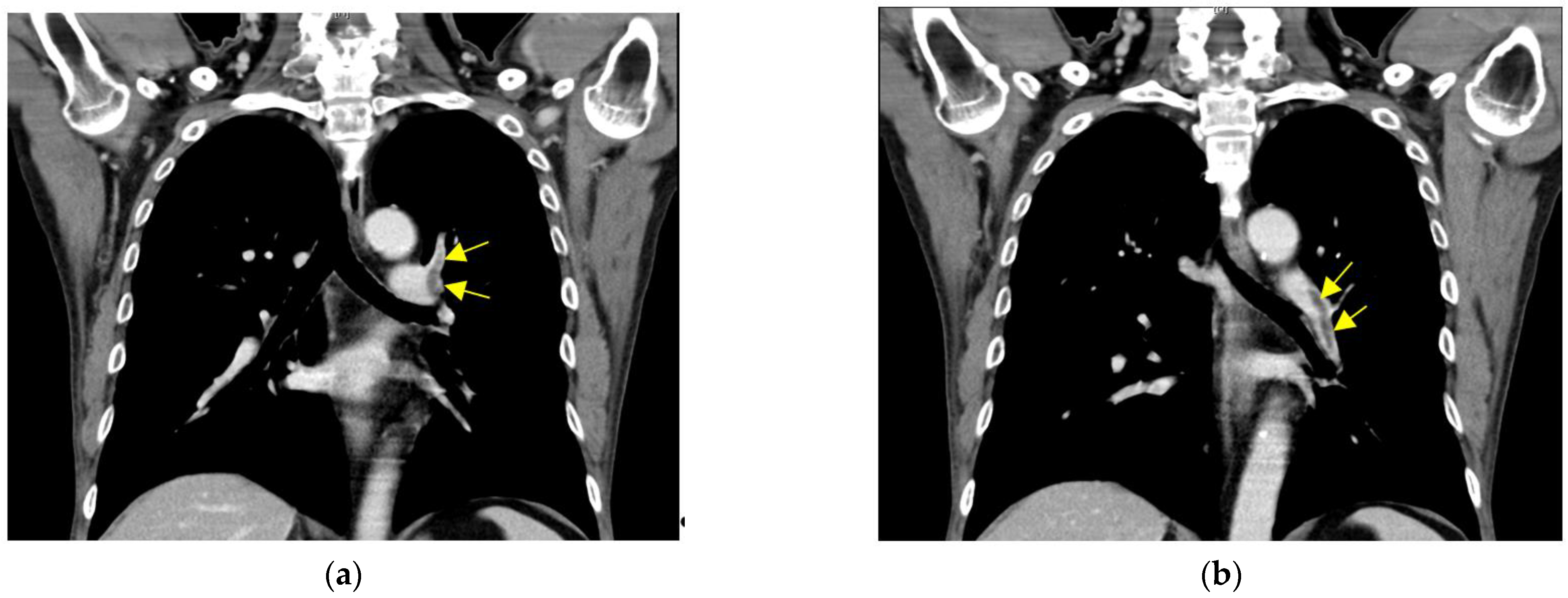 Vaccines 10 00868 g001a