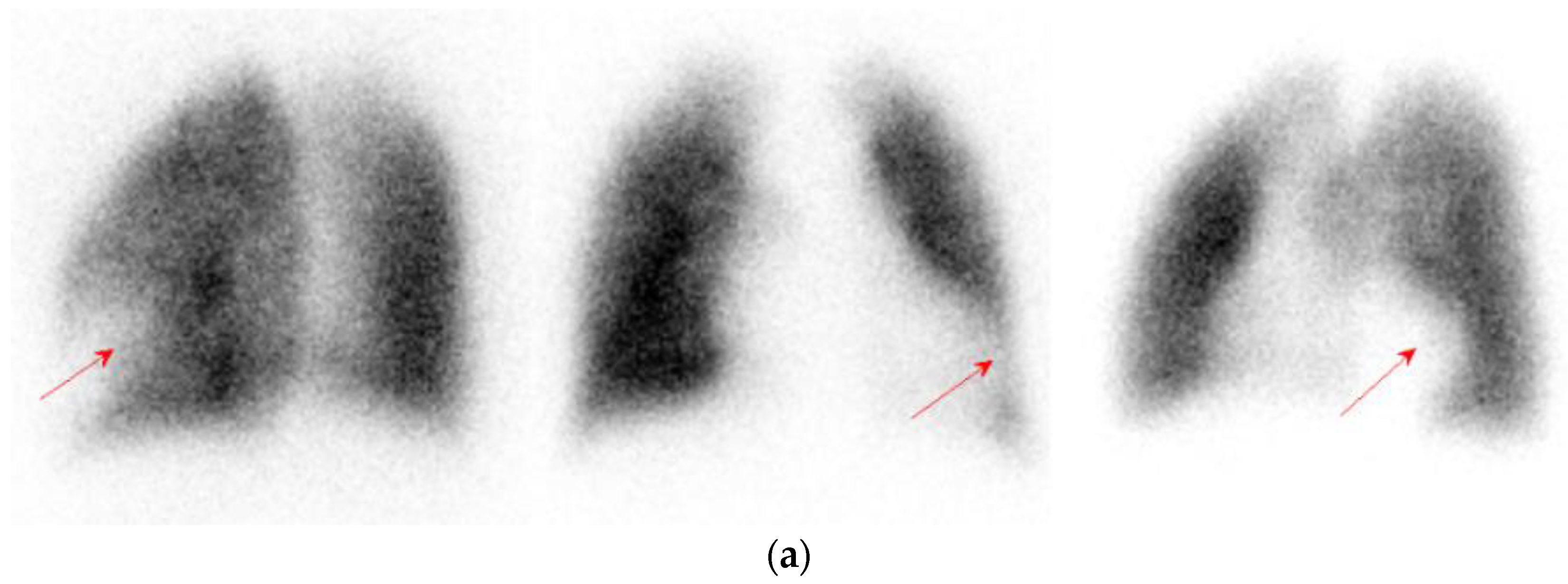 Vaccines 10 00868 g002a