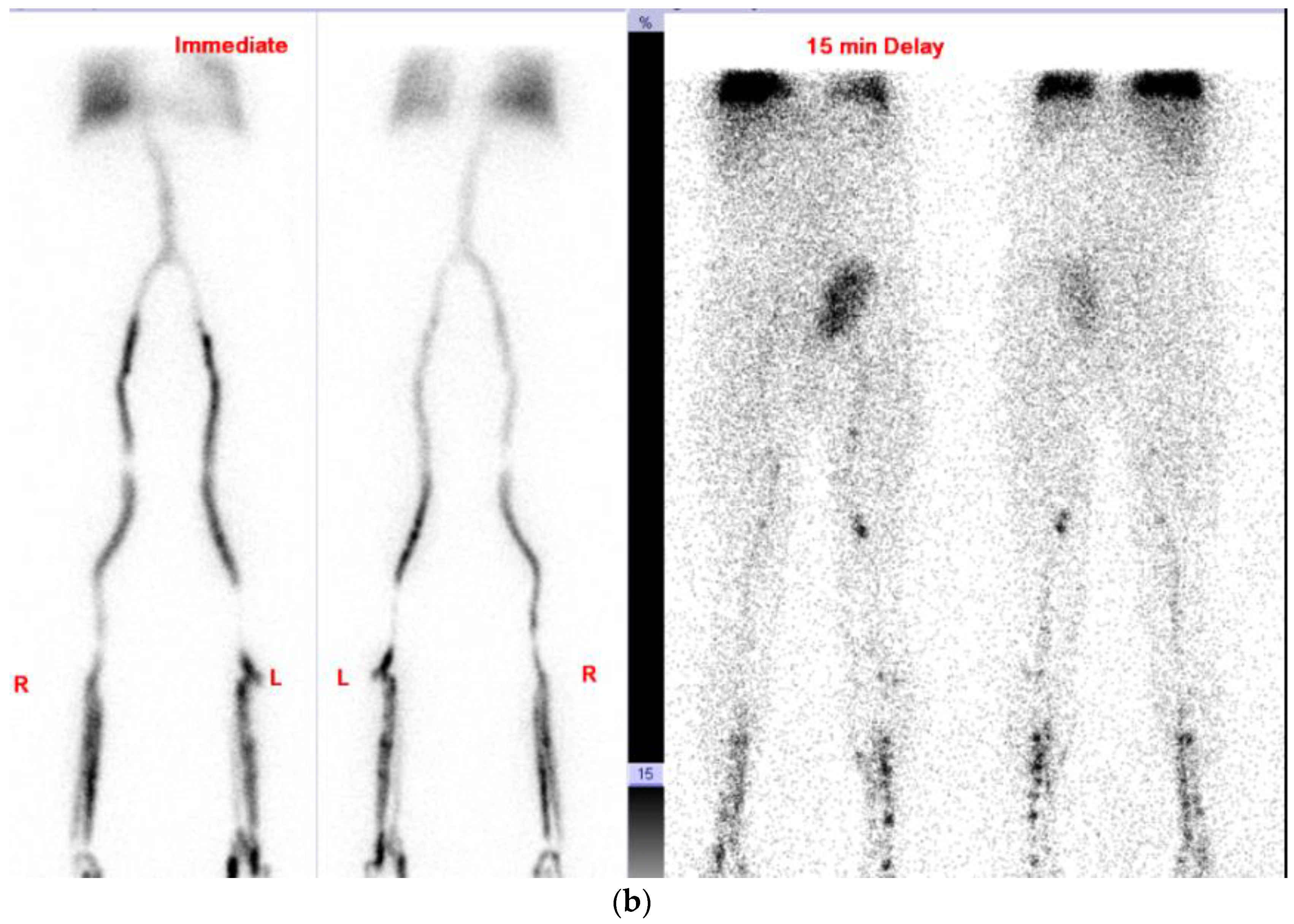 Vaccines 10 00868 g002b