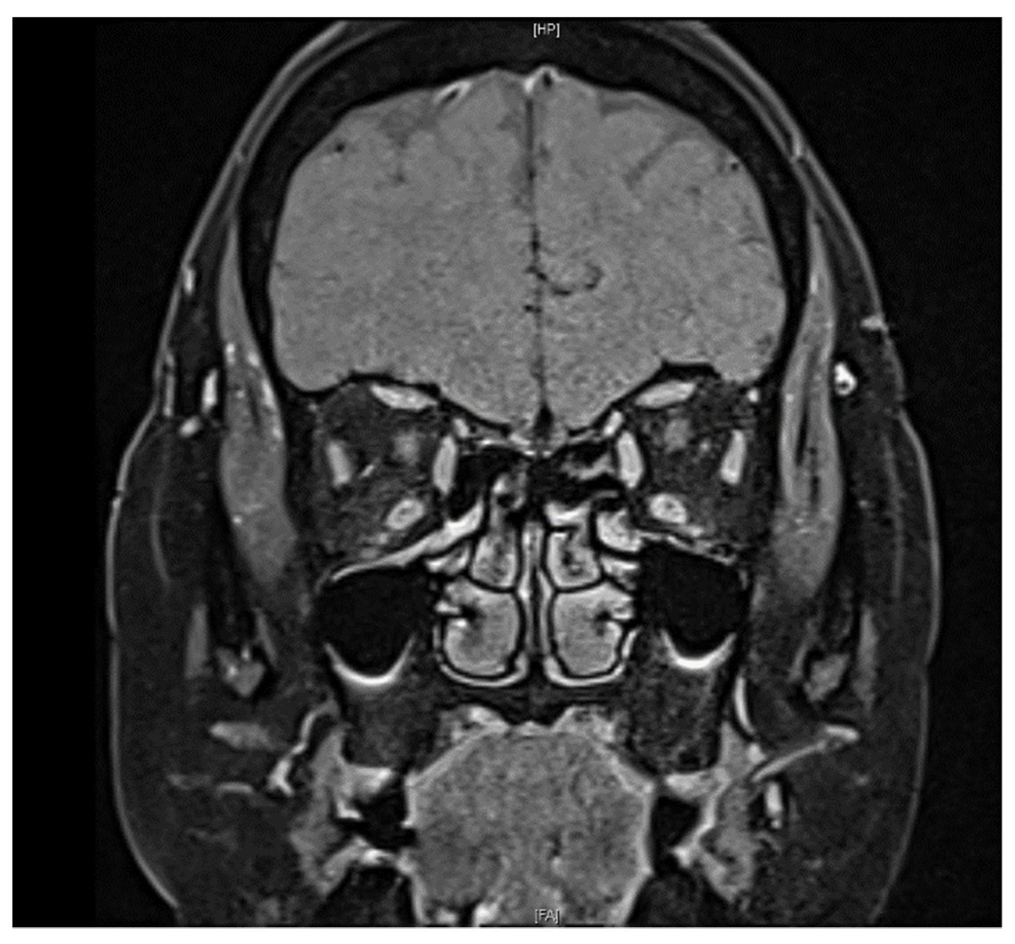 Vaccines 10 00931 g003 550