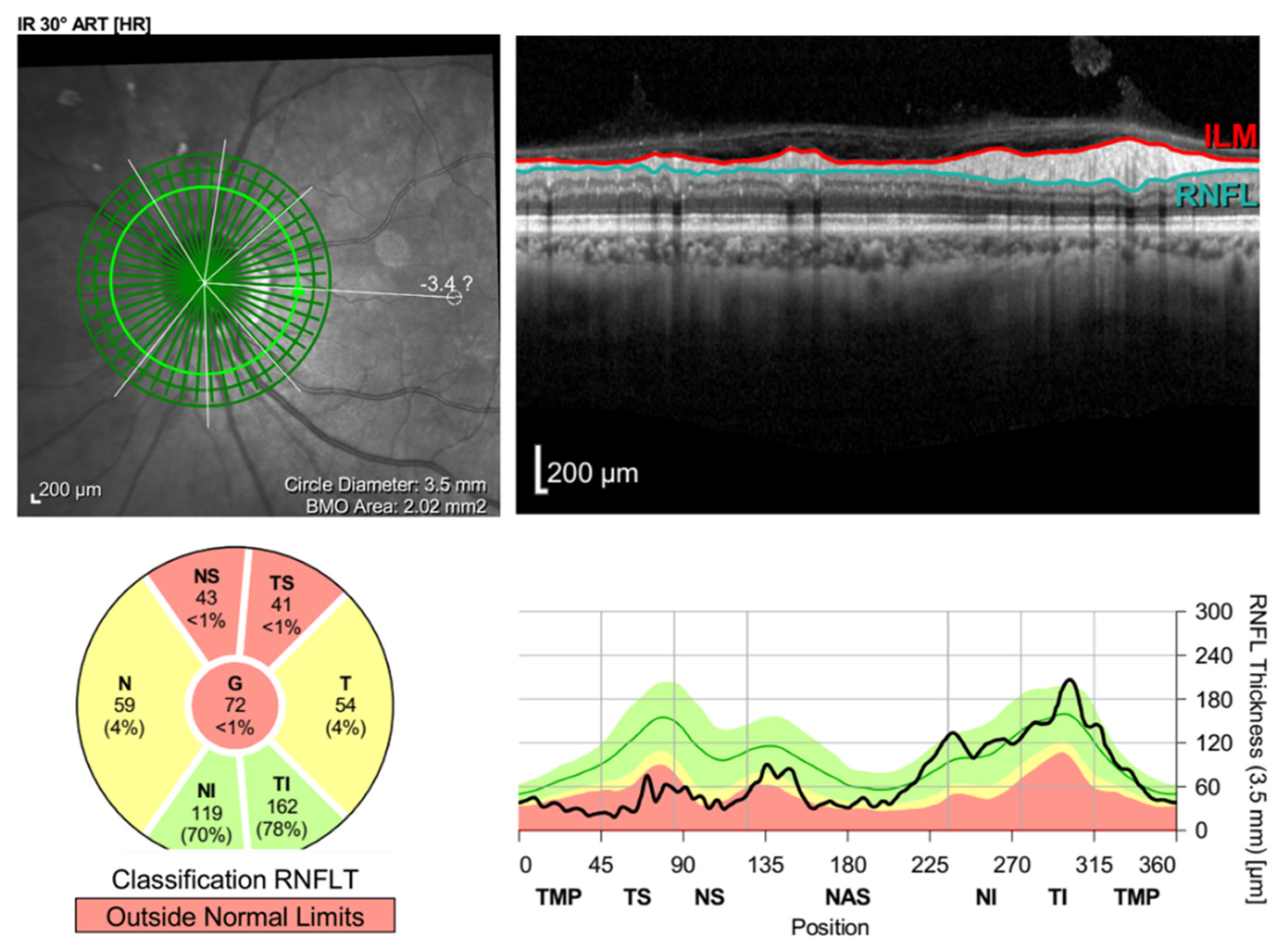 Vaccines 10 00931 g004 550