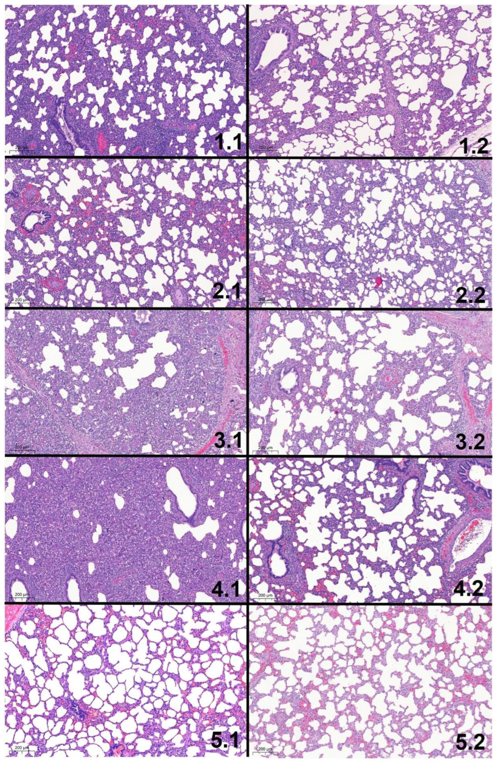 Vaccines 10 00934 g011