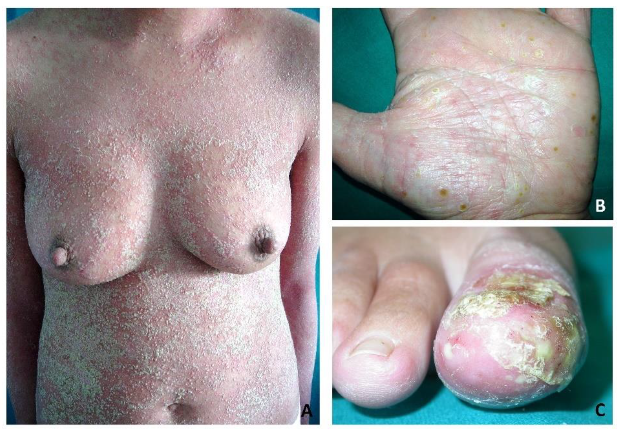 Vaccines 10 01171 g002 550