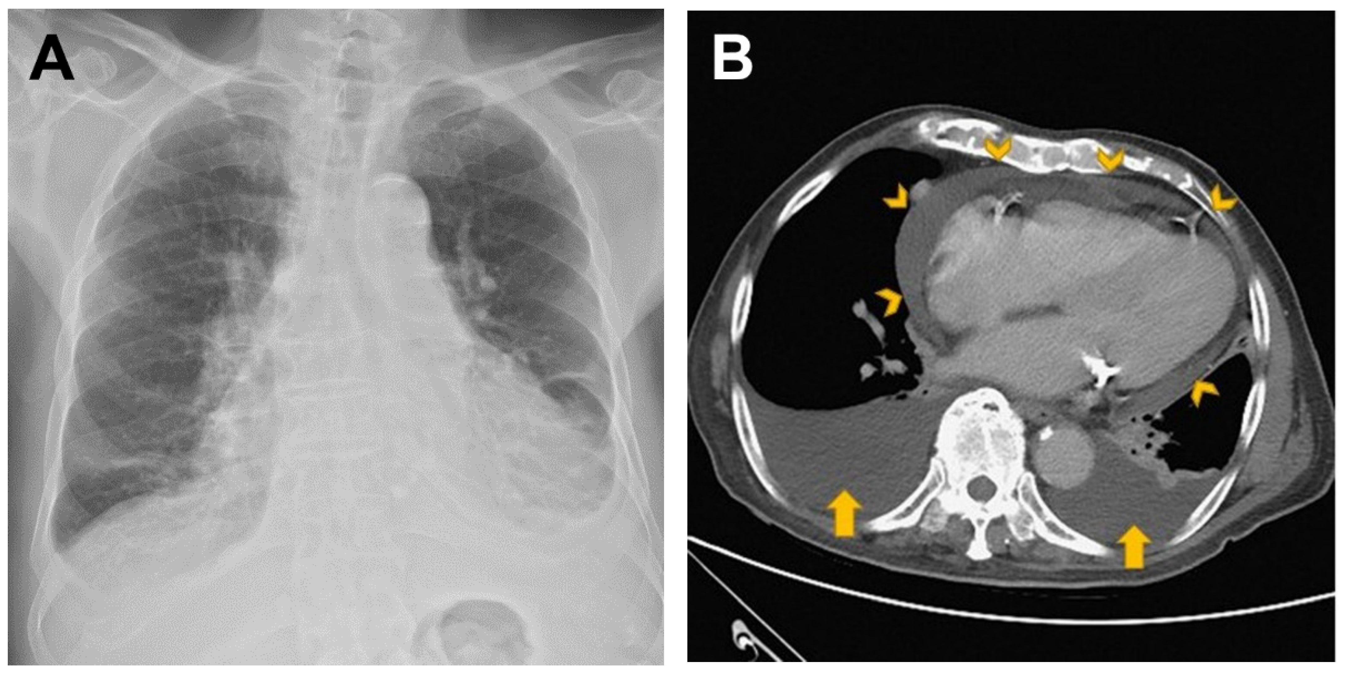 Vaccines 10 01286 g001a