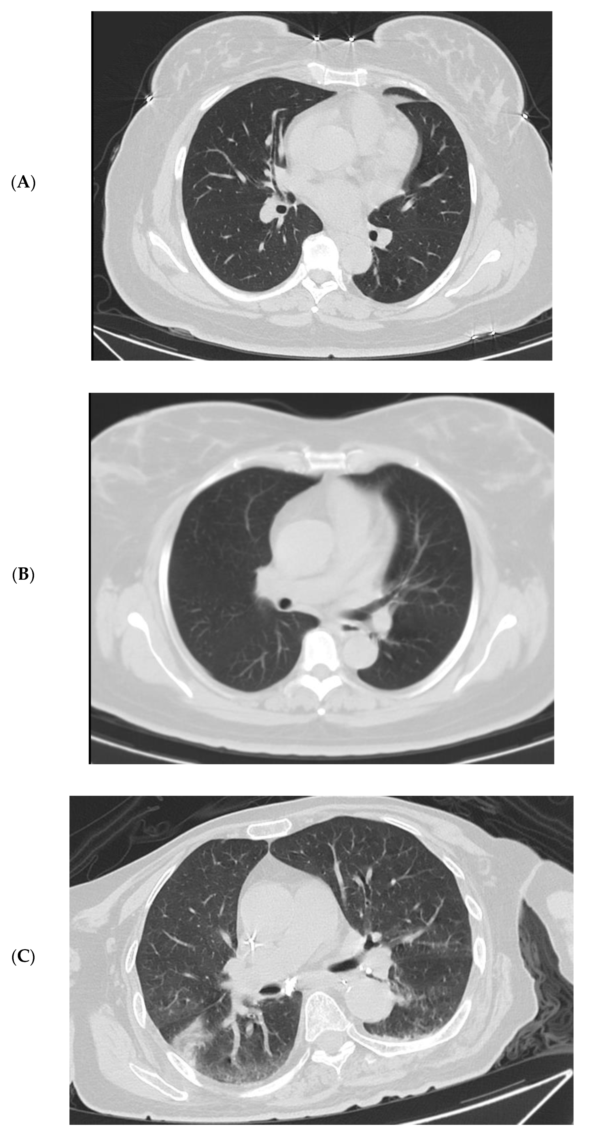 Vaccines 10 01409 g005a