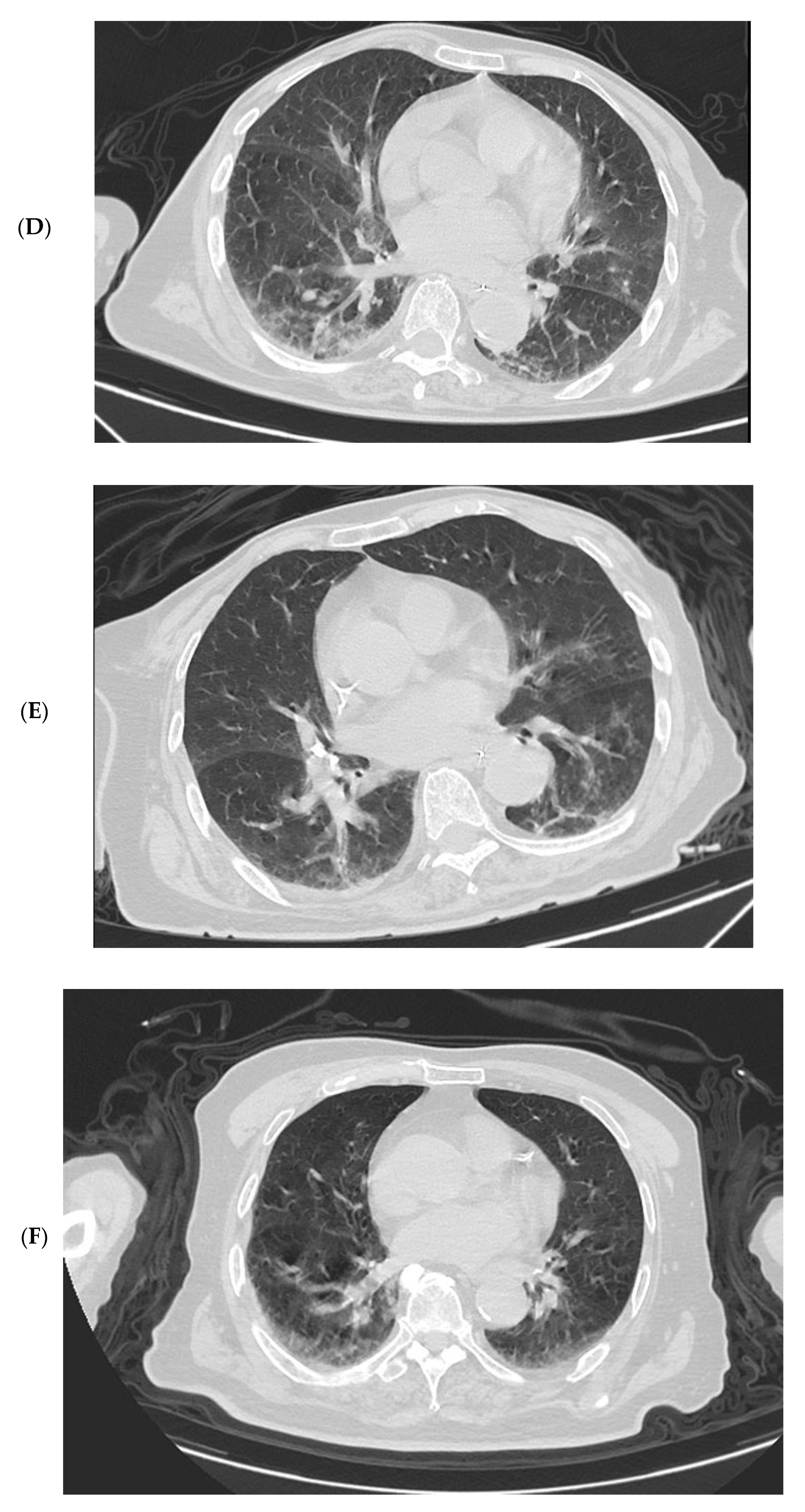 Vaccines 10 01409 g005b