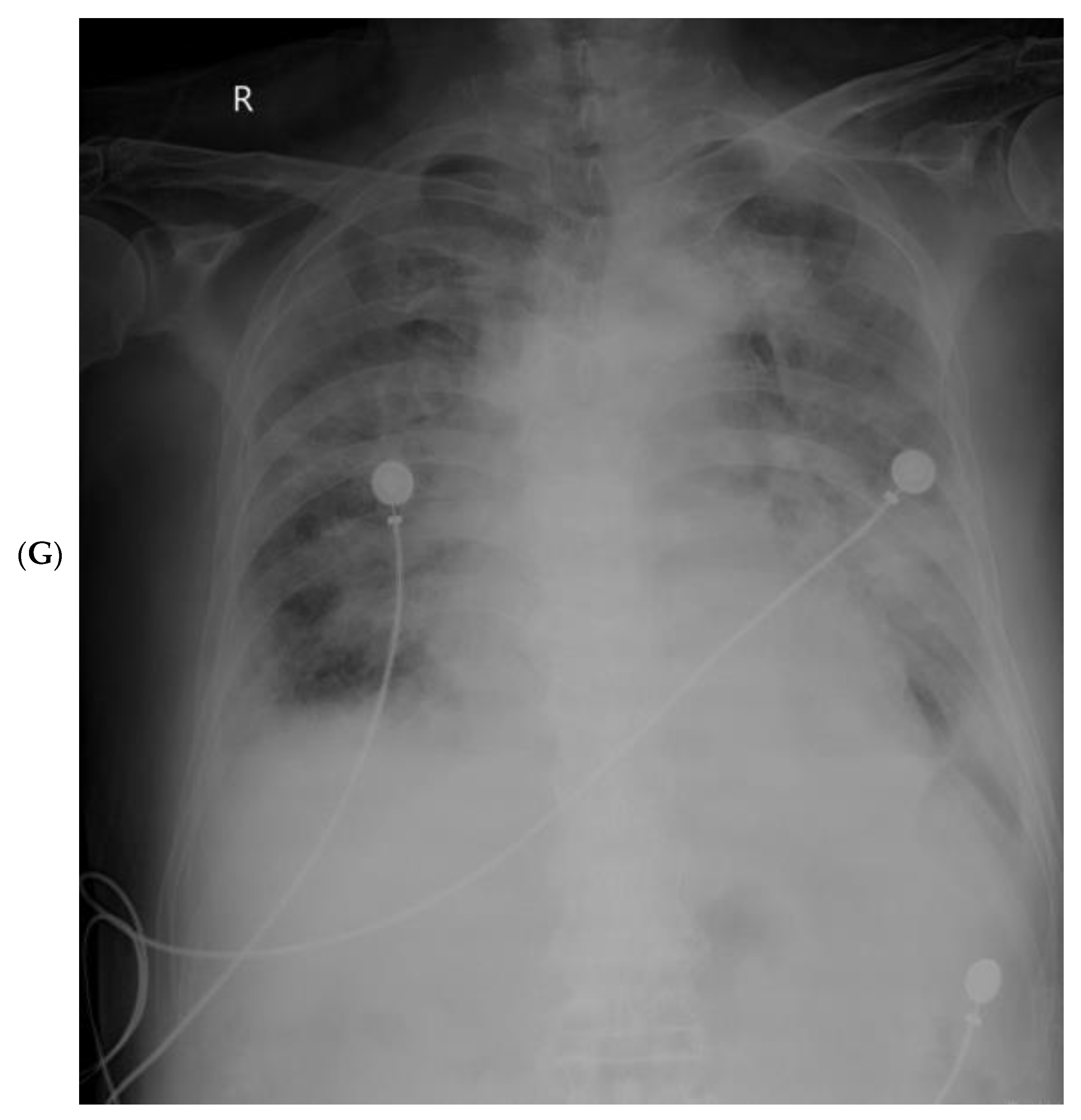 Vaccines 10 01409 g005c