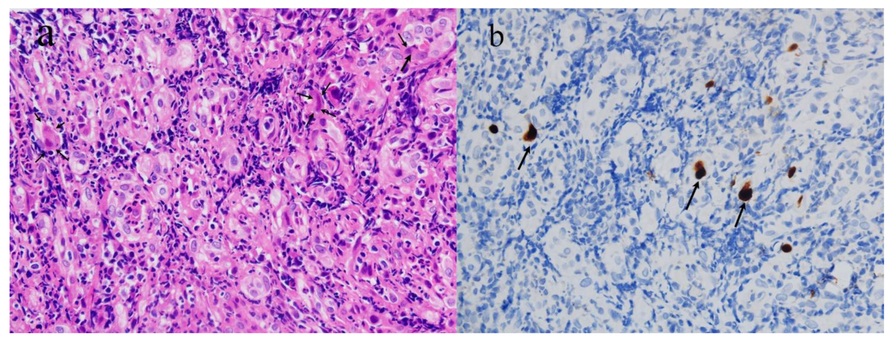 Vaccines 10 01417 g002 550