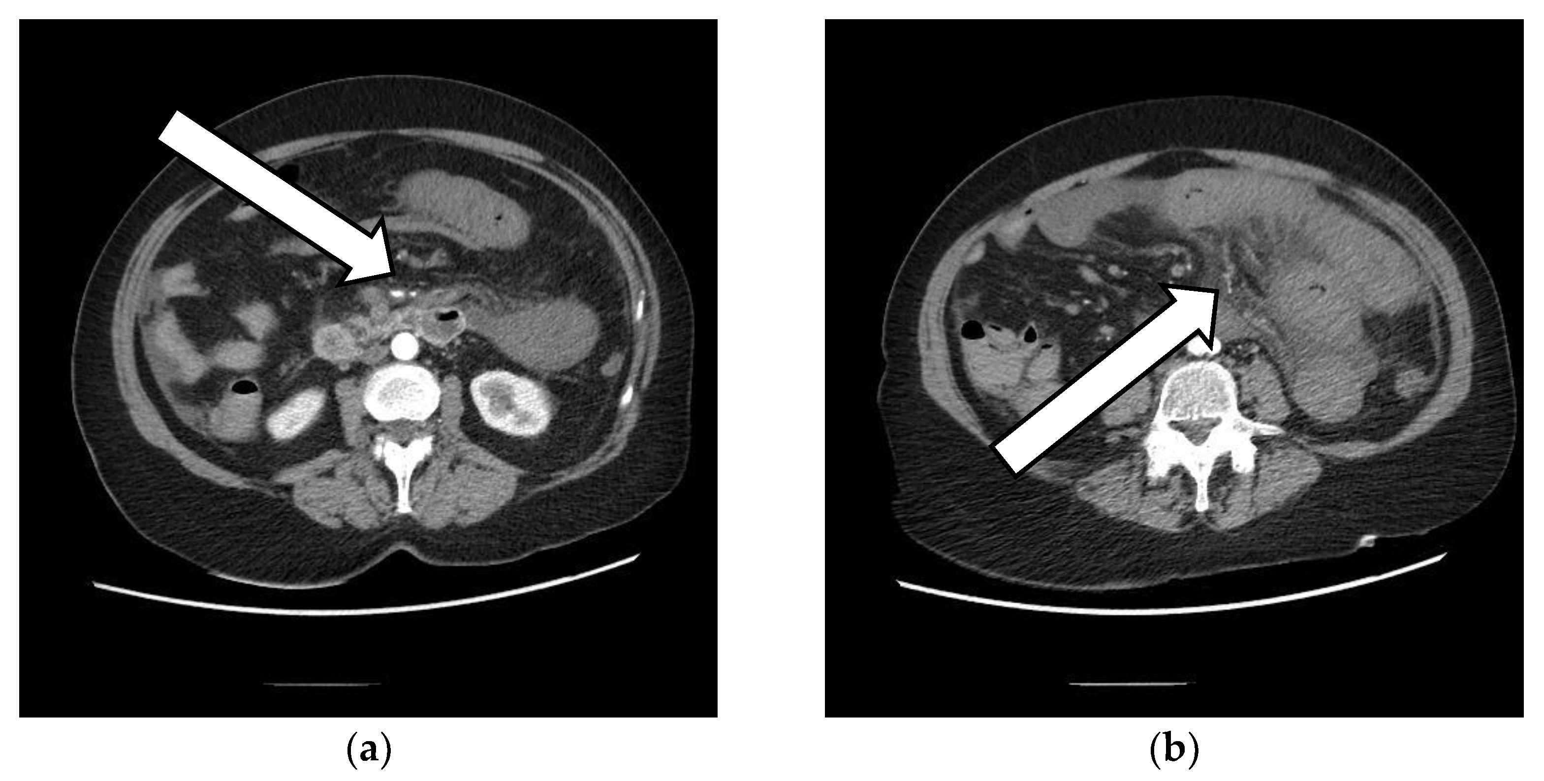 Vaccines 10 01950 g001 Vaccines 10 01950 g001