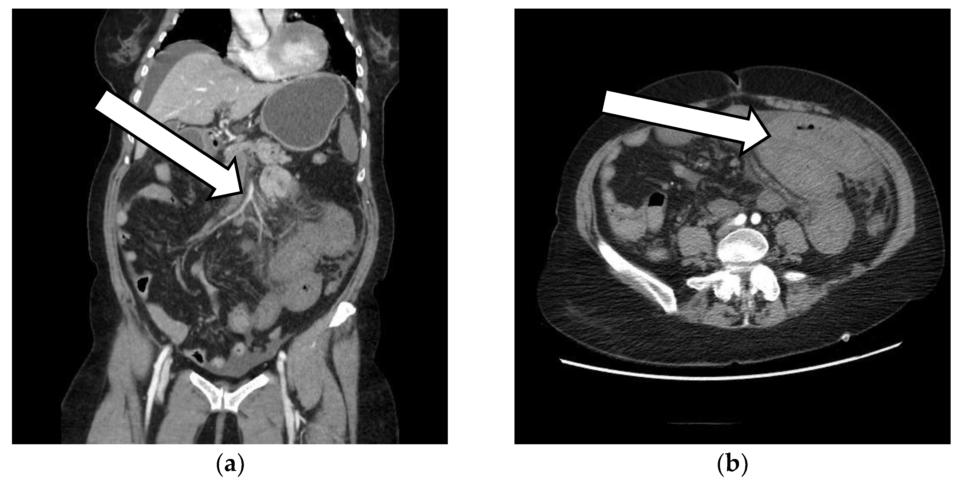 Vaccines 10 01950 g002 Vaccines 10 01950 g002