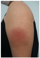 Vaccines 10 02048 i002