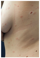 Vaccines 10 02048 i003