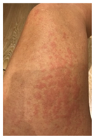 Vaccines 10 02048 i004