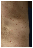 Vaccines 10 02048 i005