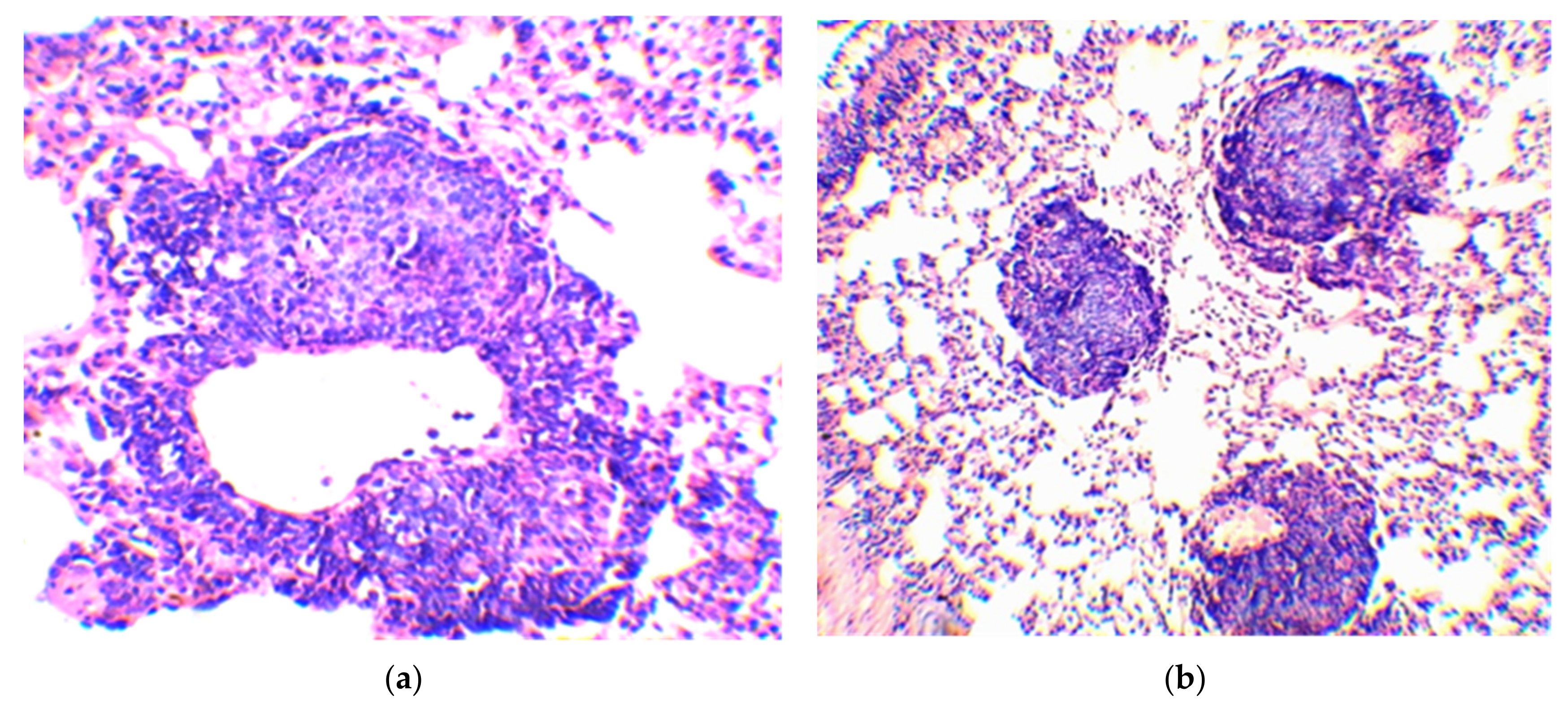 Vaccines 10 02084 g003 Vaccines 10 02084 g003