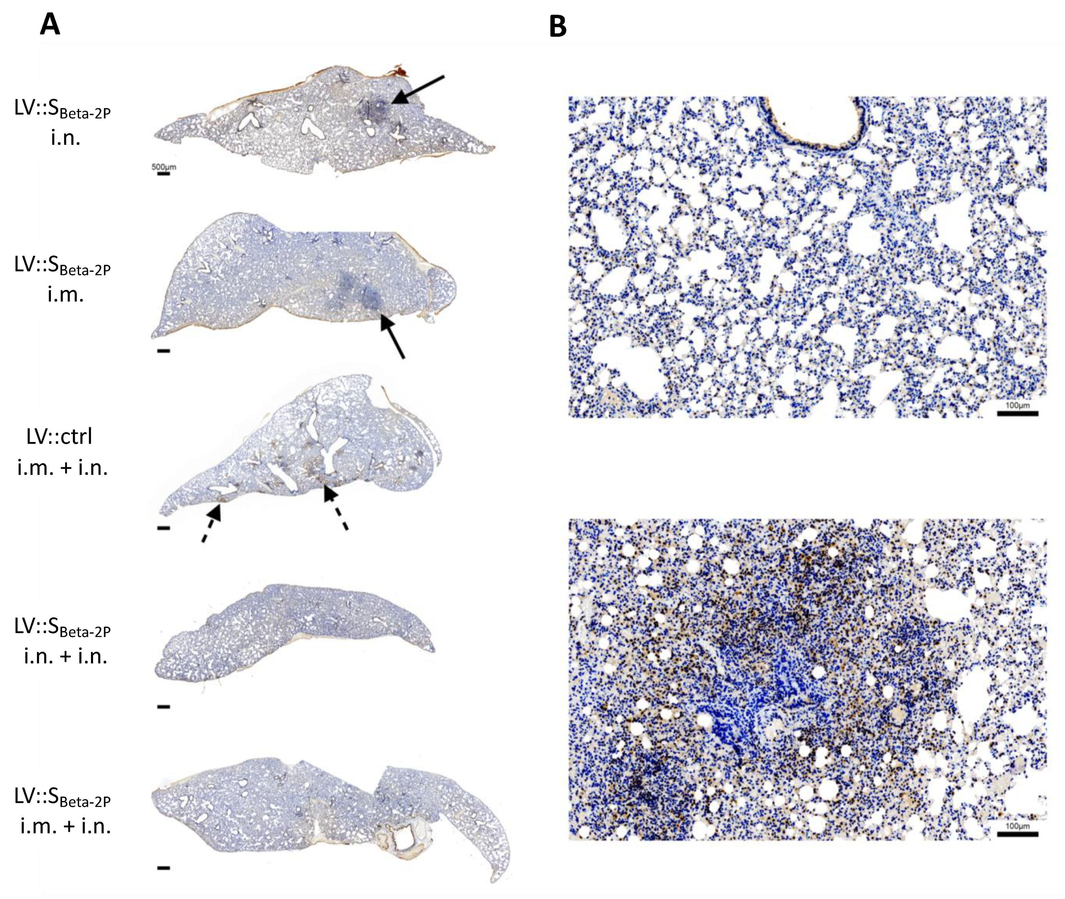 Vaccines 11 00012 g006 Vaccines 11 00012 g006