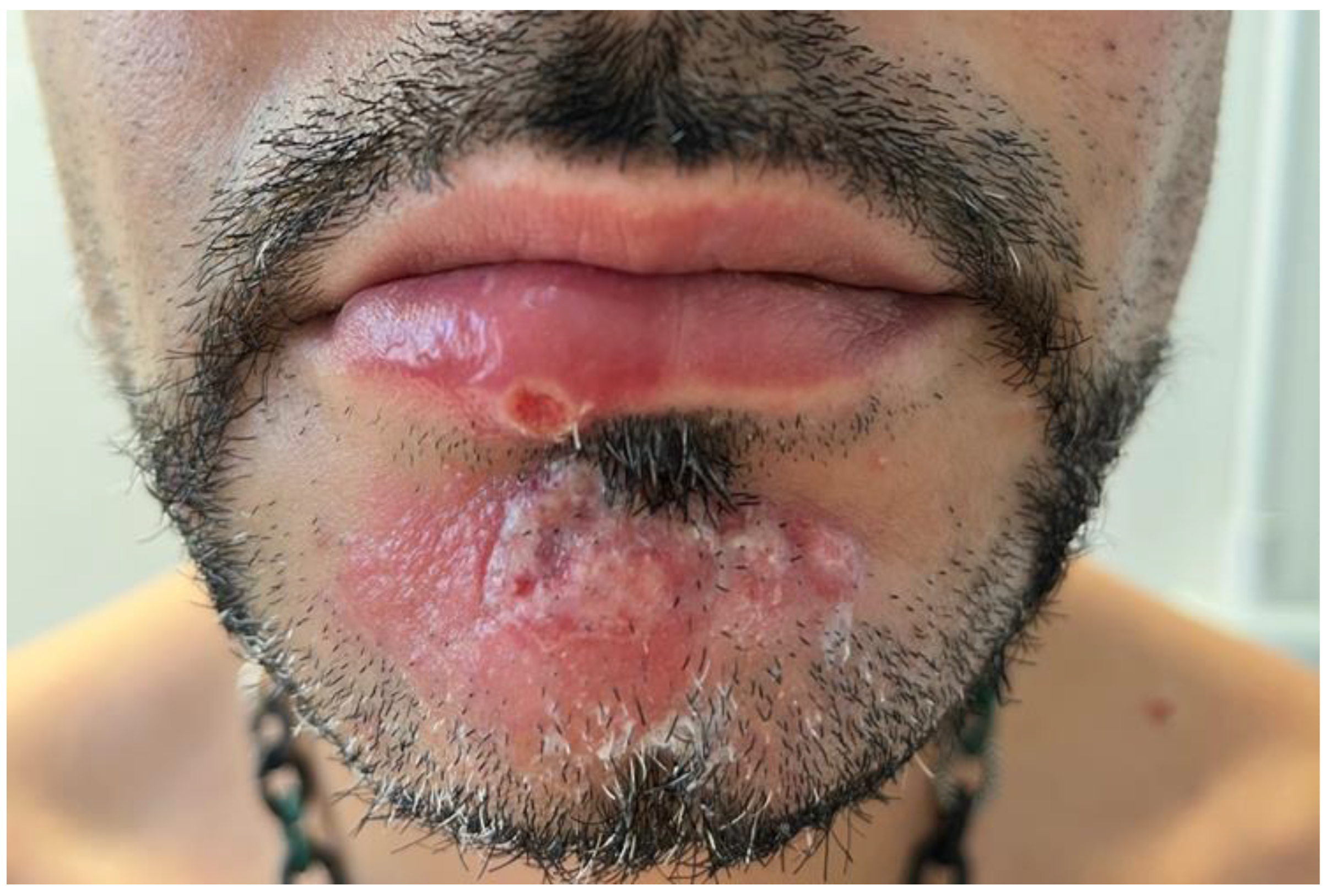 Vaccines 11 00036 g001