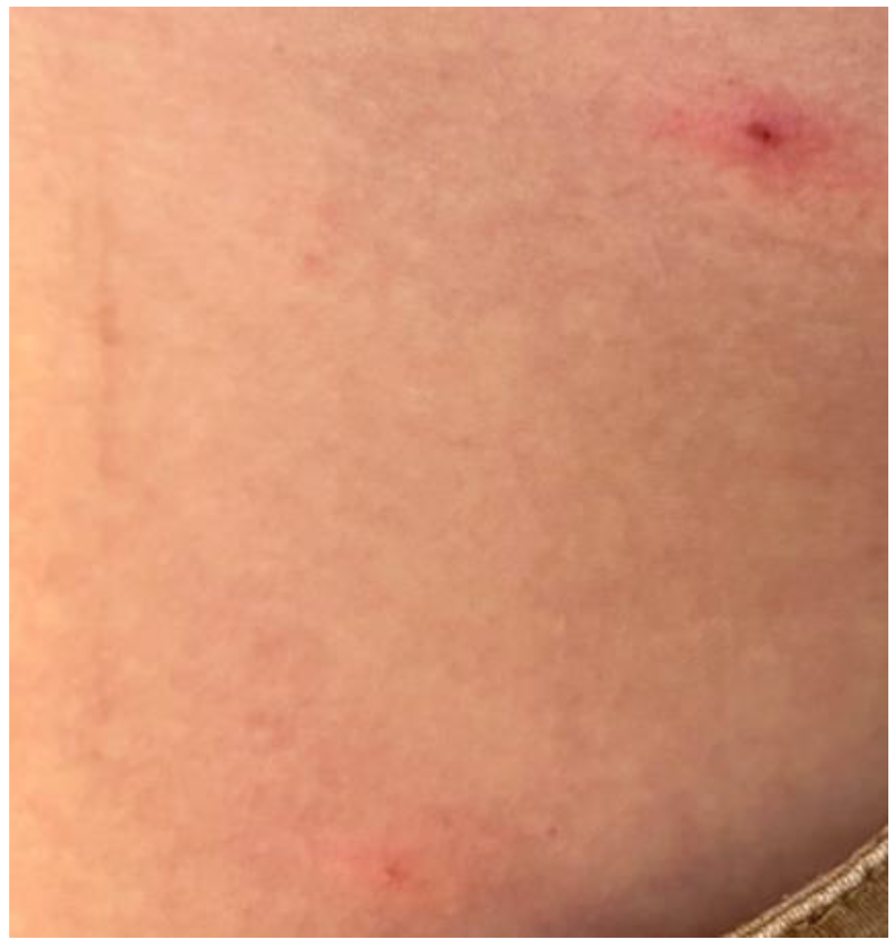 Vaccines 11 00036 g002