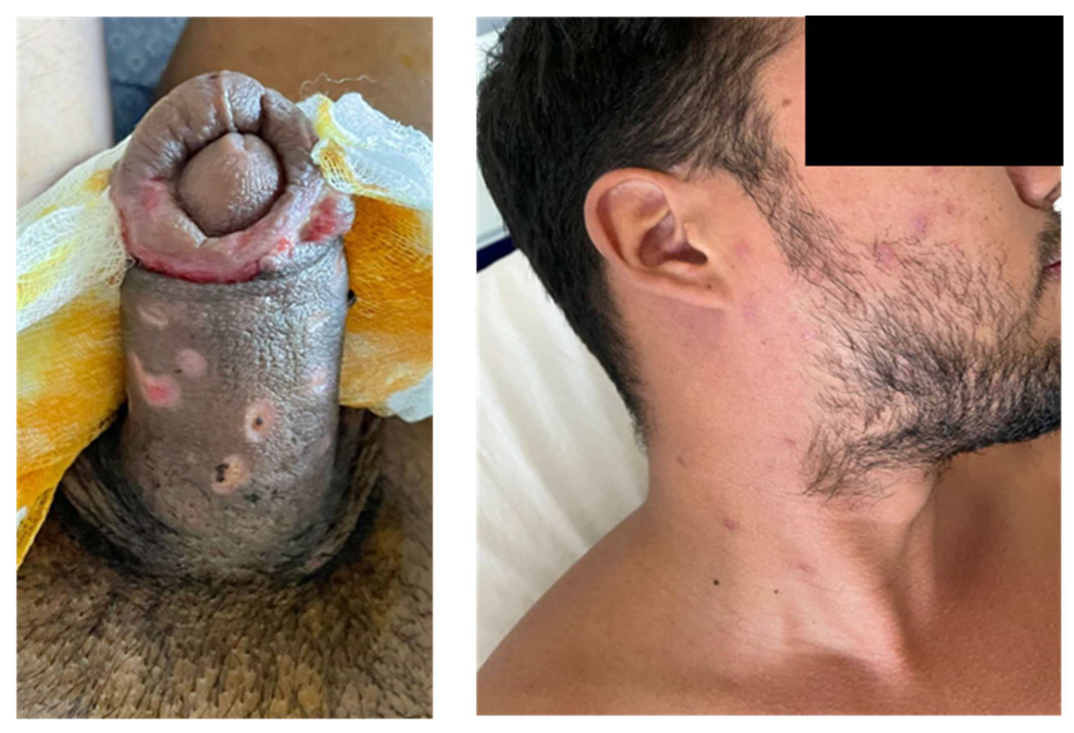 Vaccines 11 00063 g004