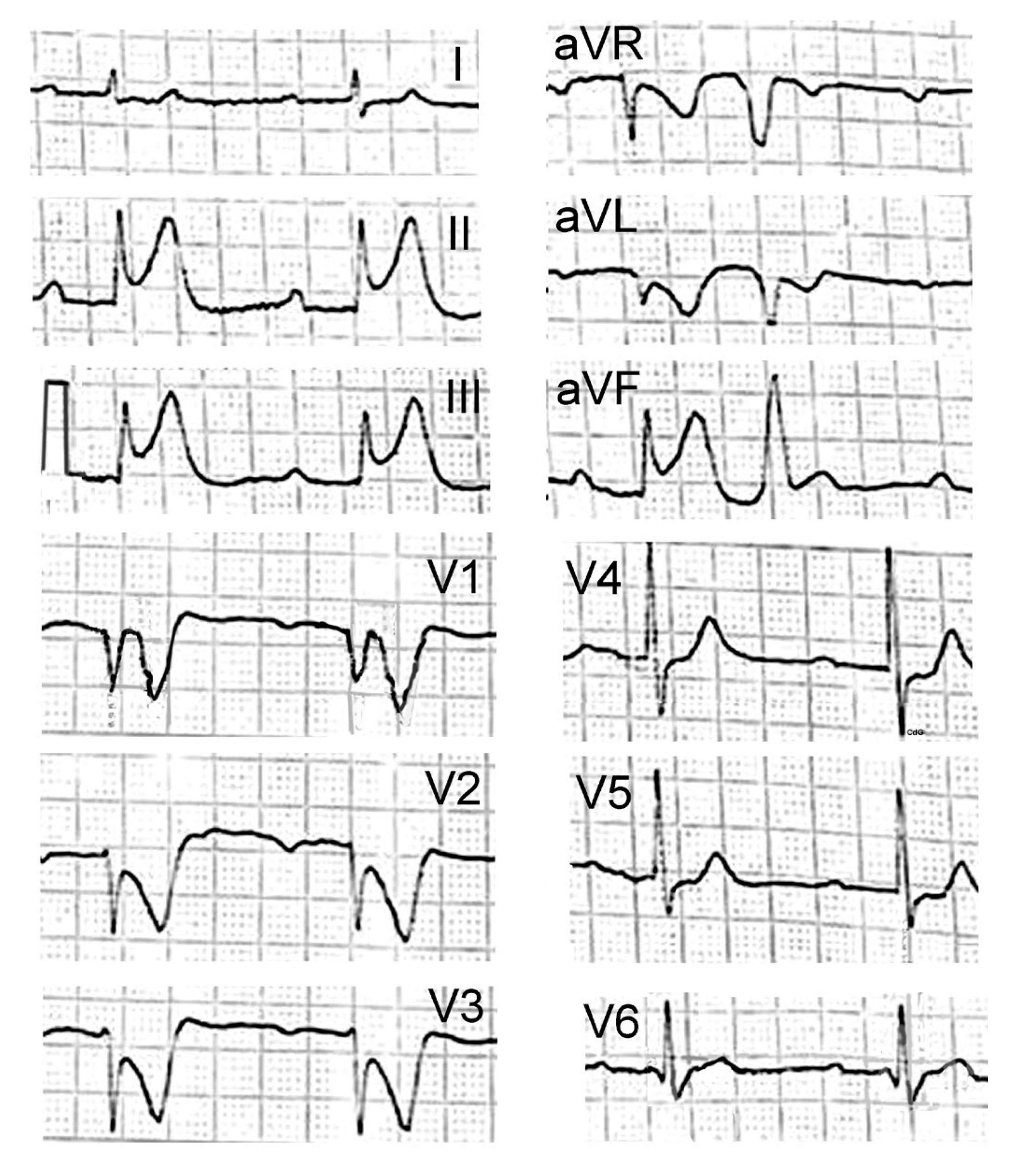 Vaccines 11 00220 g002