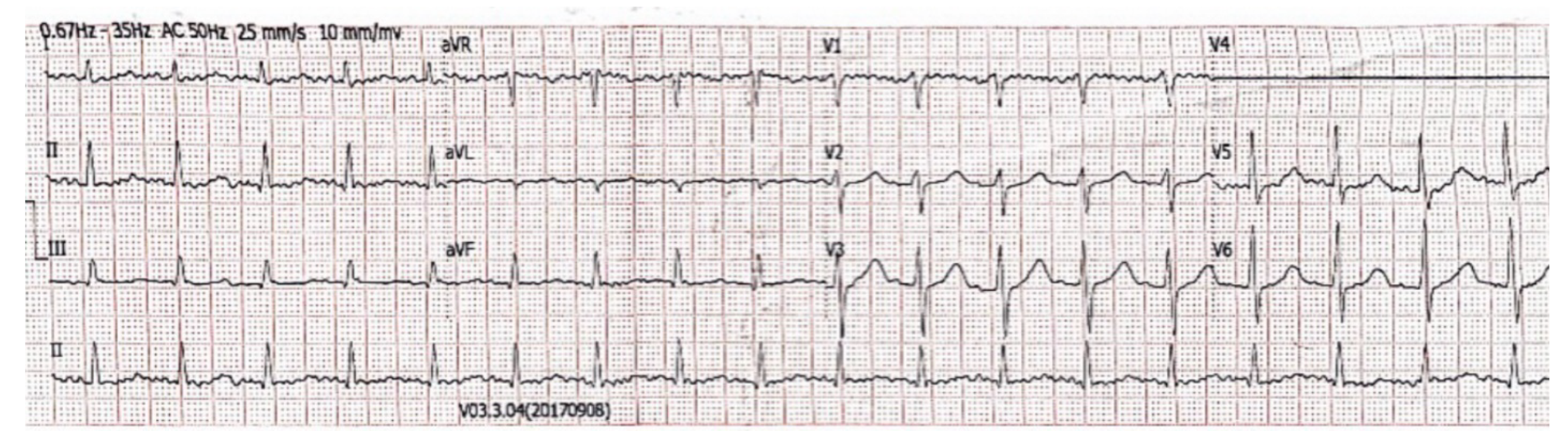 Vaccines 11 00220 g003