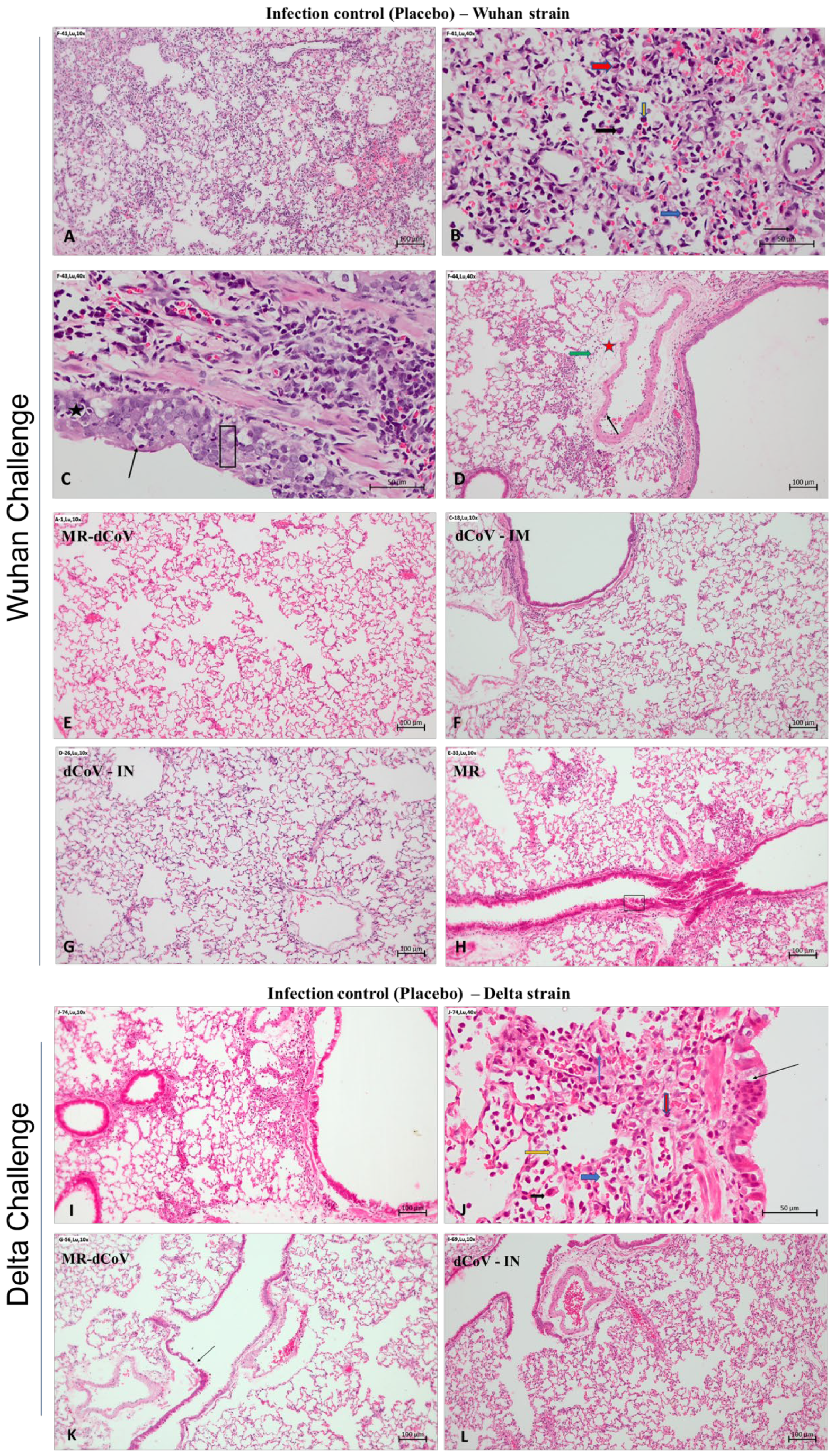 Vaccines 11 00255 g005