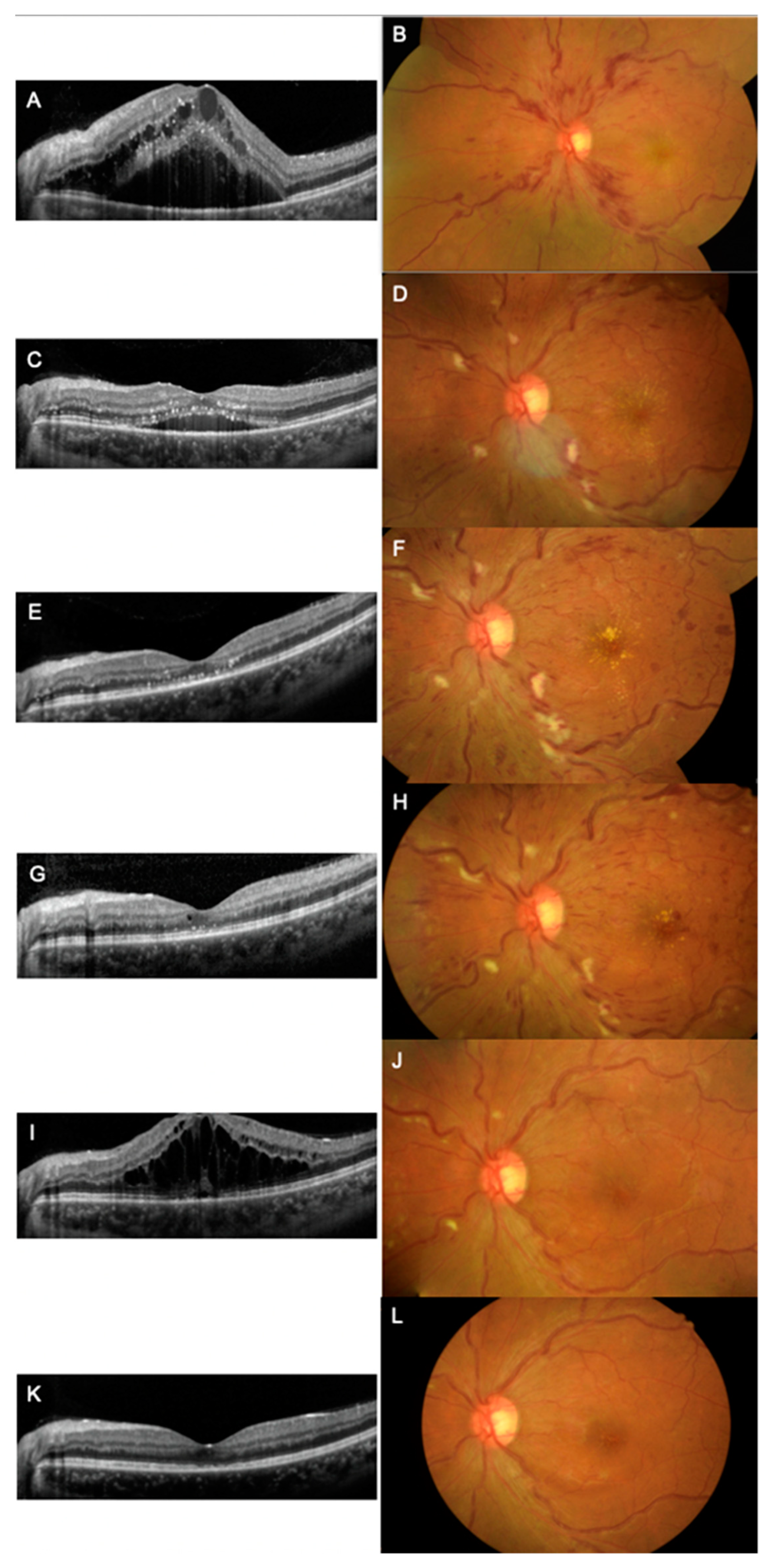 Vaccines 11 00365 g001 550