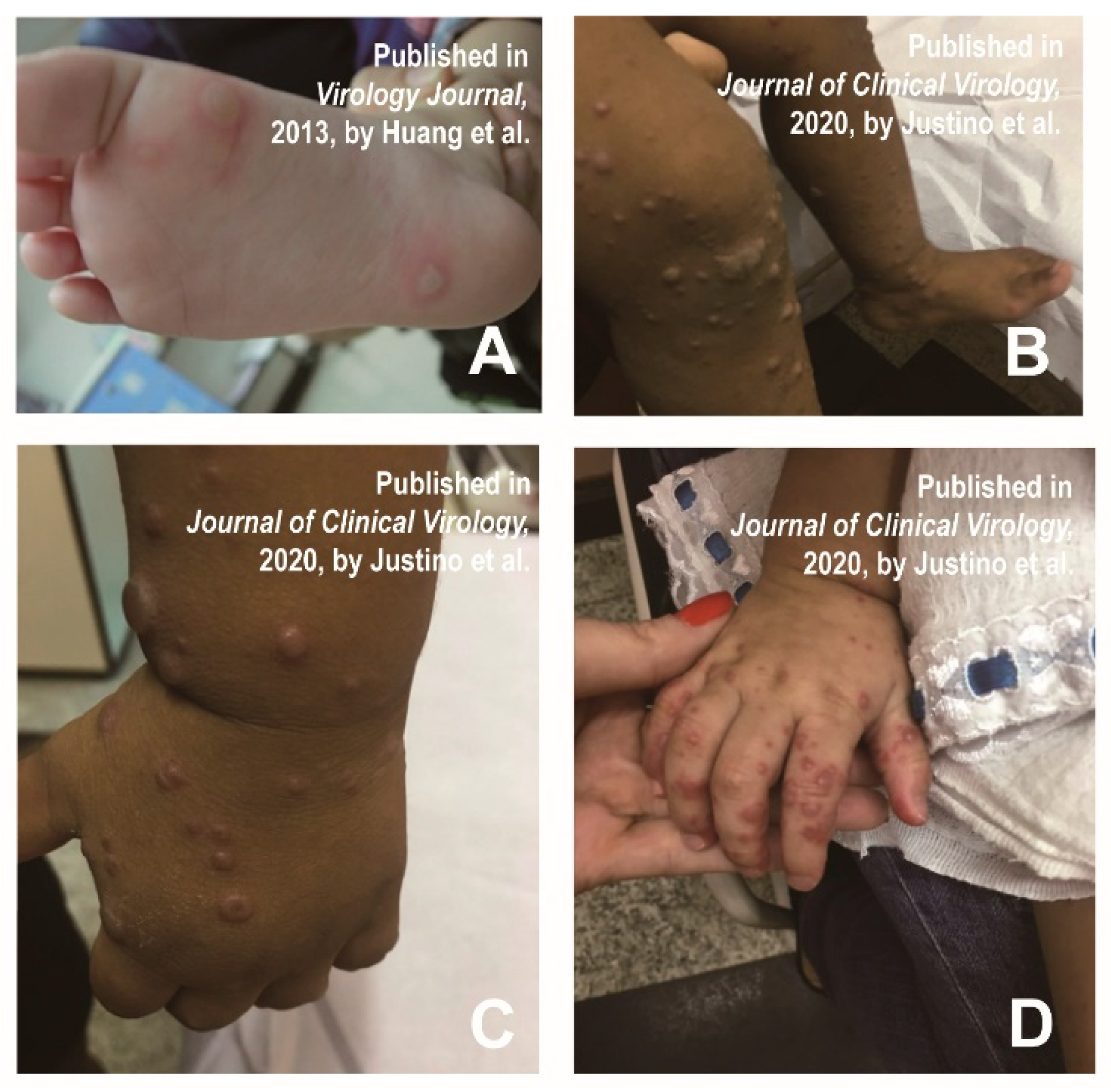 Vaccines 11 00405 g004 Vaccines 11 00405 g004