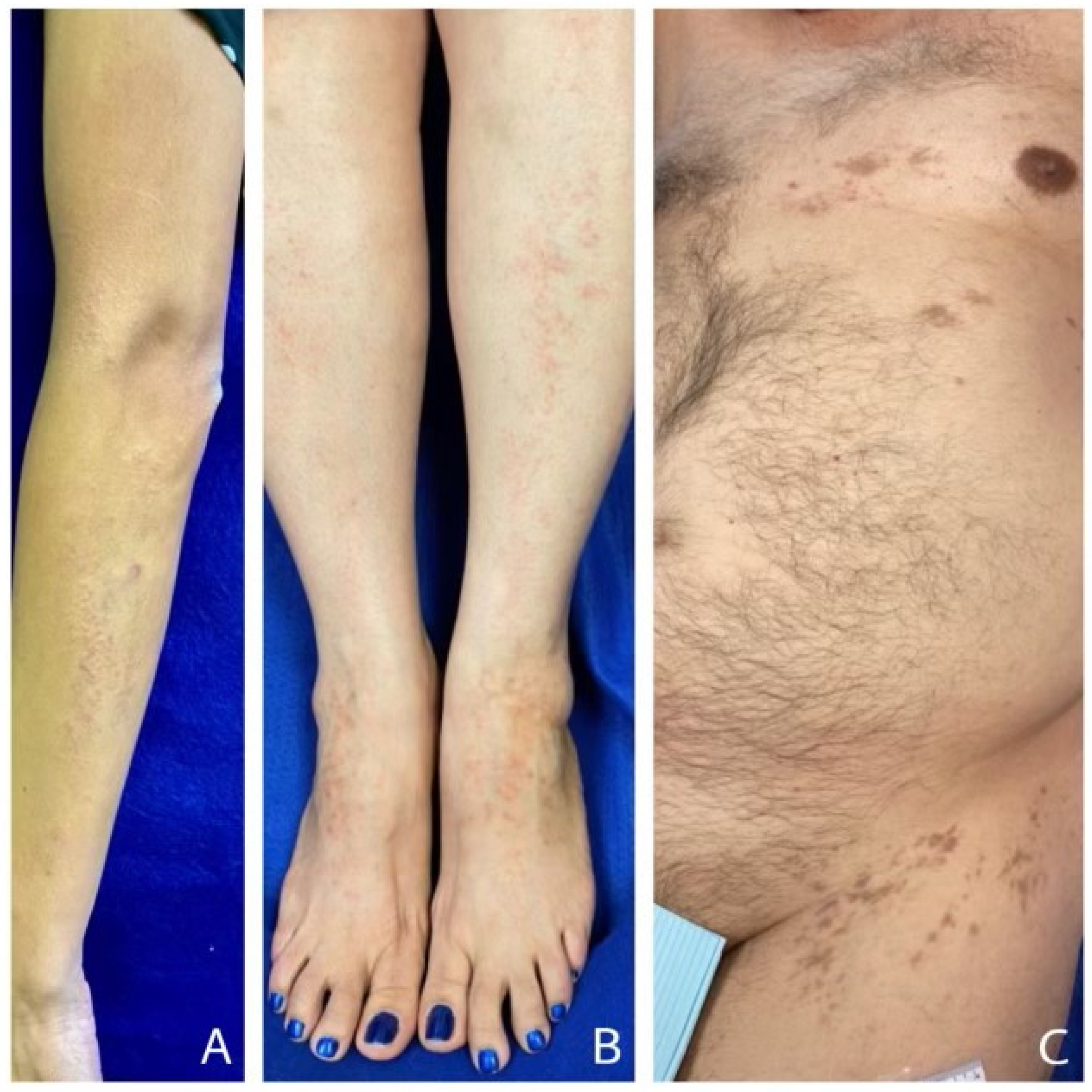 Vaccines 11 00438 g004