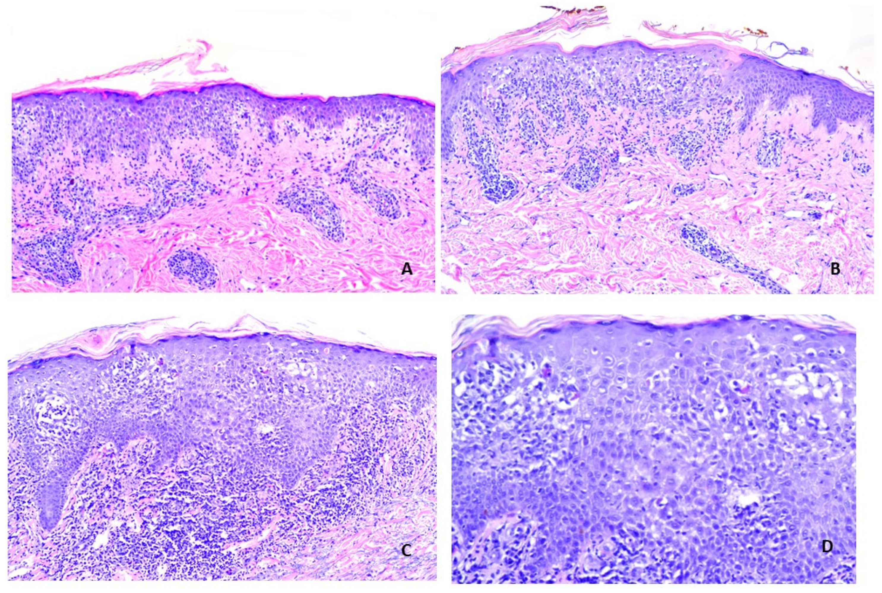 Vaccines 11 00438 g005