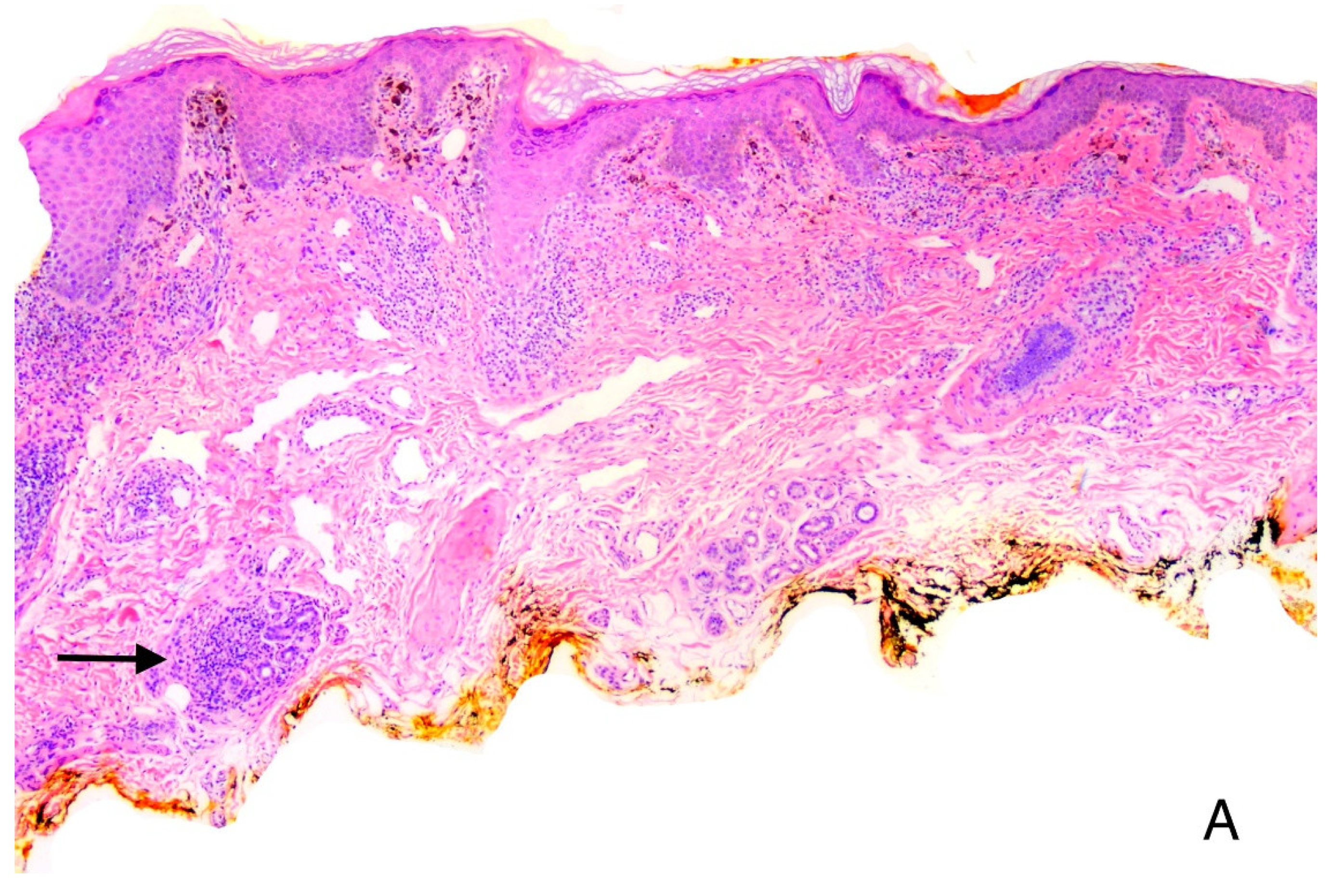 Vaccines 11 00438 g009a