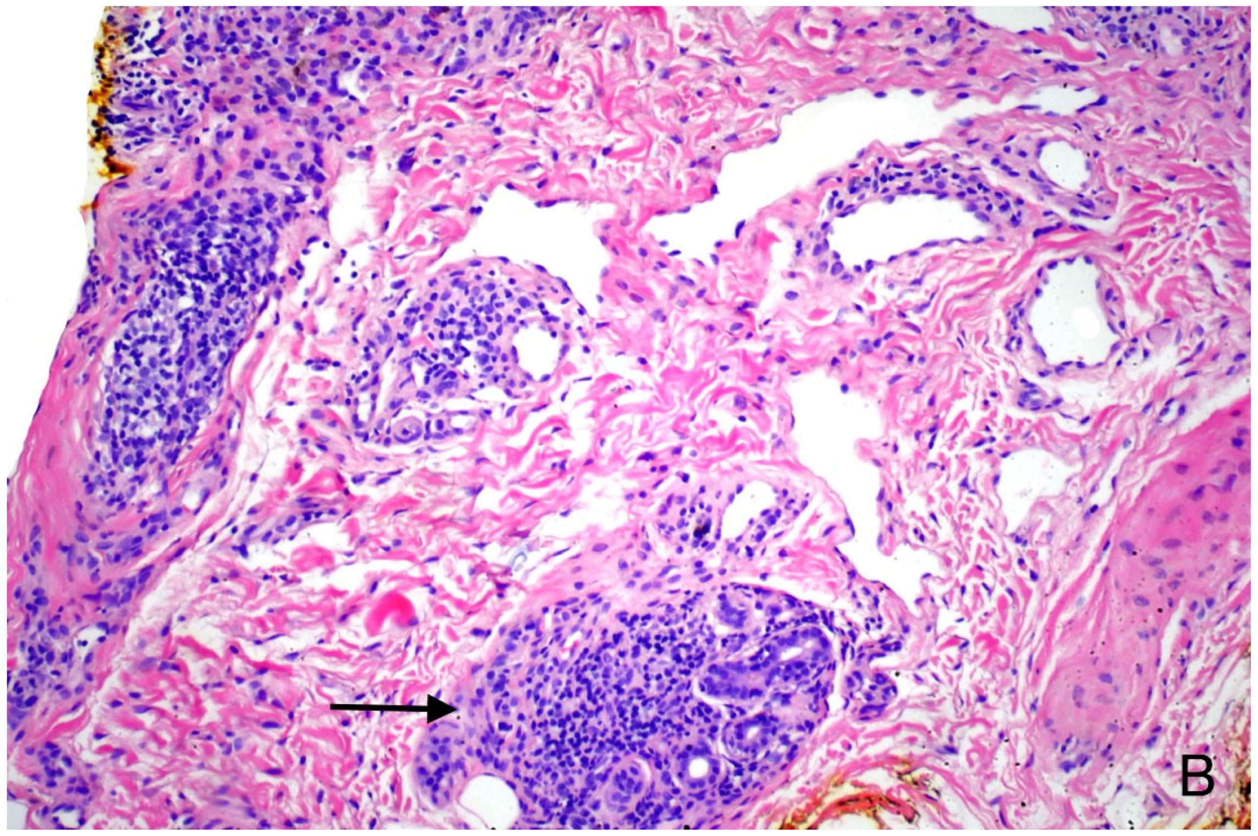 Vaccines 11 00438 g009b