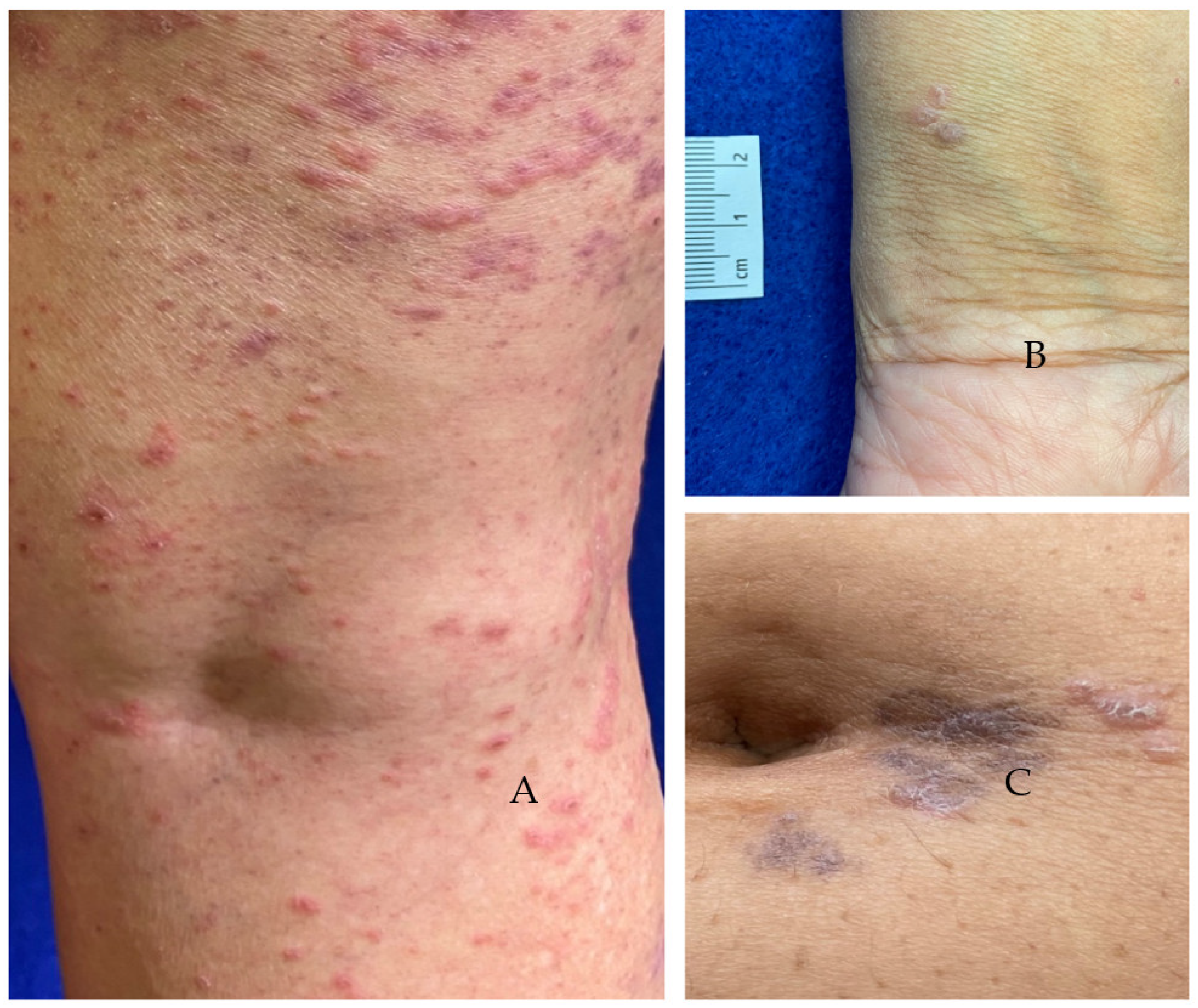 Vaccines 11 00438 g010