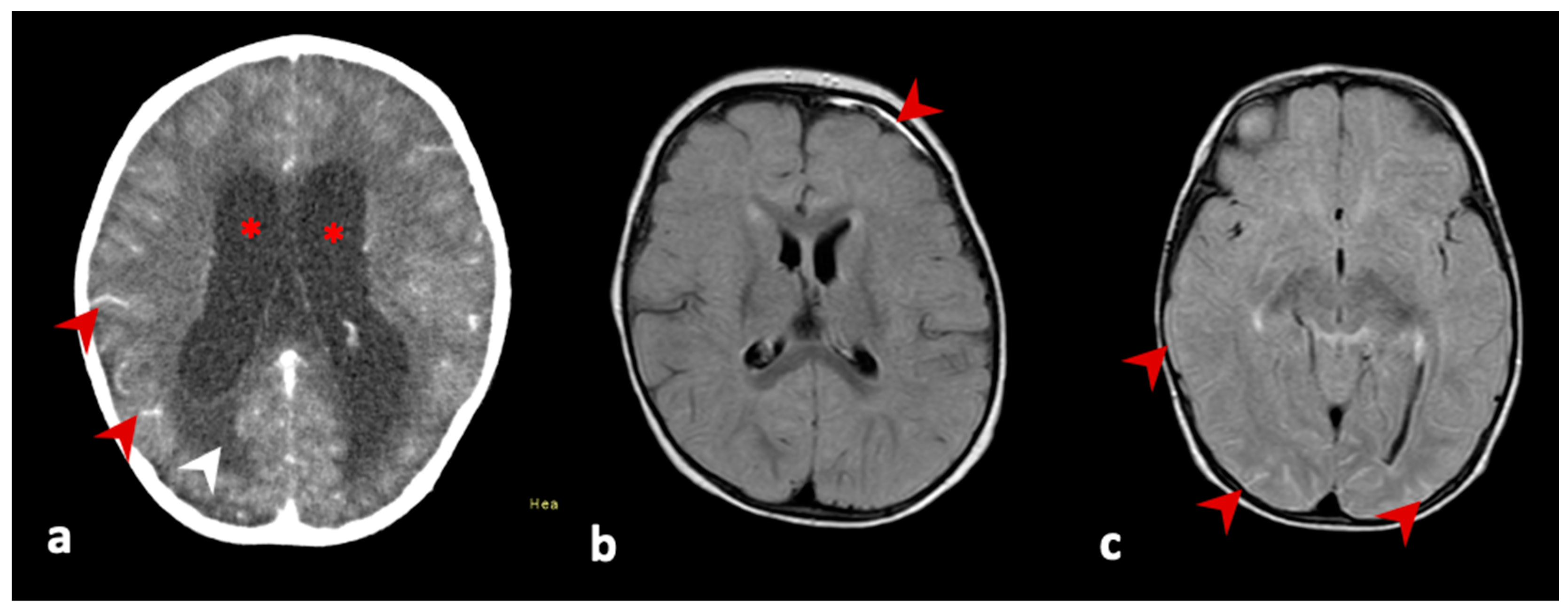 Vaccines 11 00445 g001