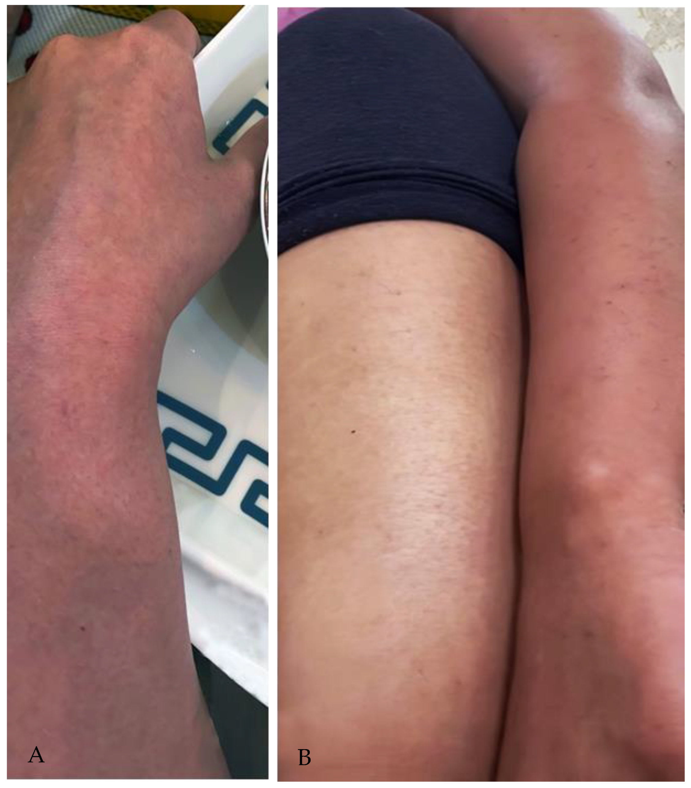 Vaccines 11 00467 g001 Vaccines 11 00467 g001