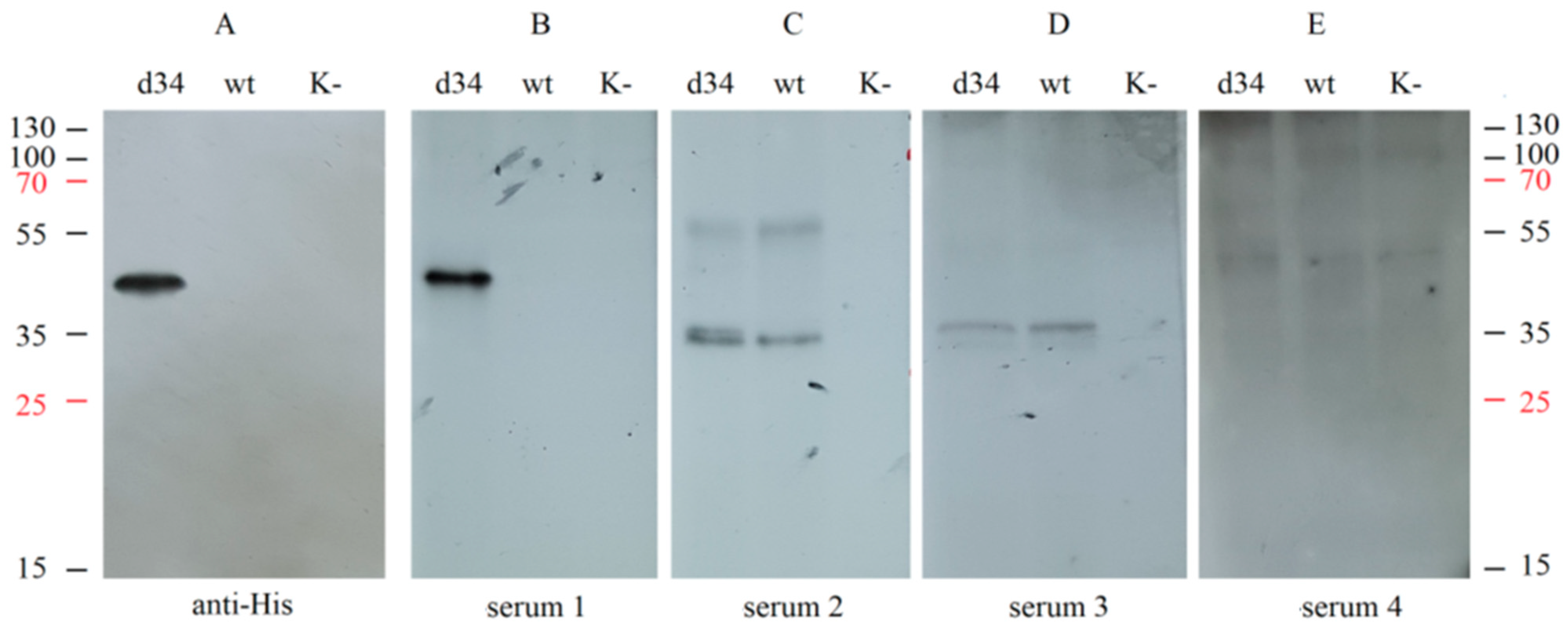 Vaccines 11 00831 g004