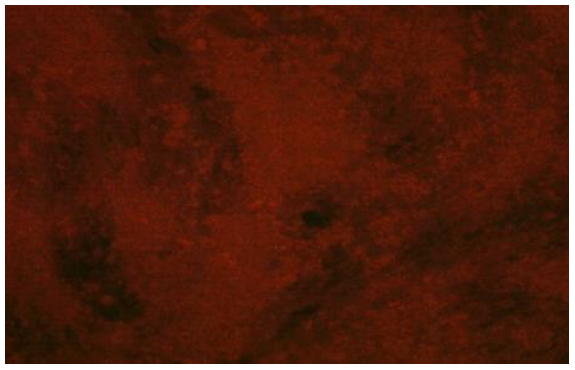 Vaccines 11 00885 g003 Vaccines 11 00885 g003