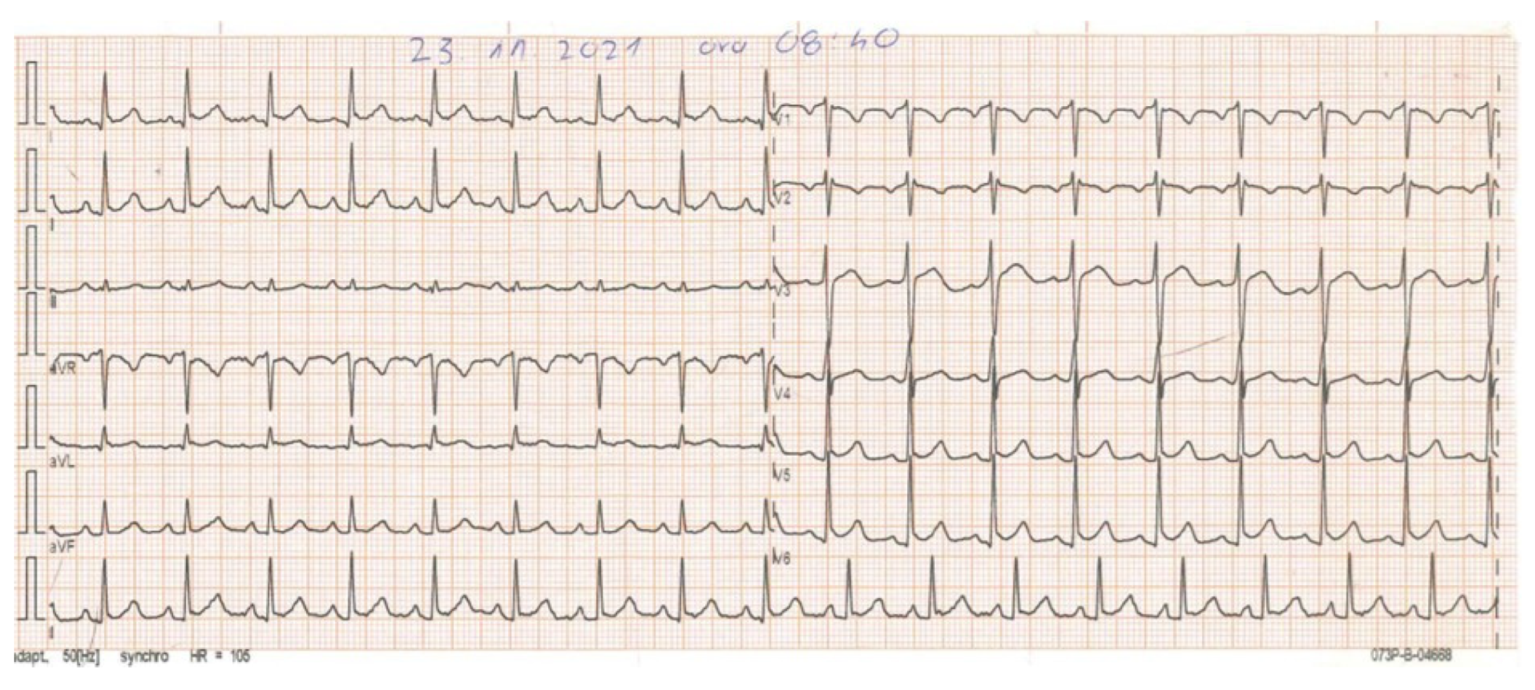 Vaccines 11 00956 g001