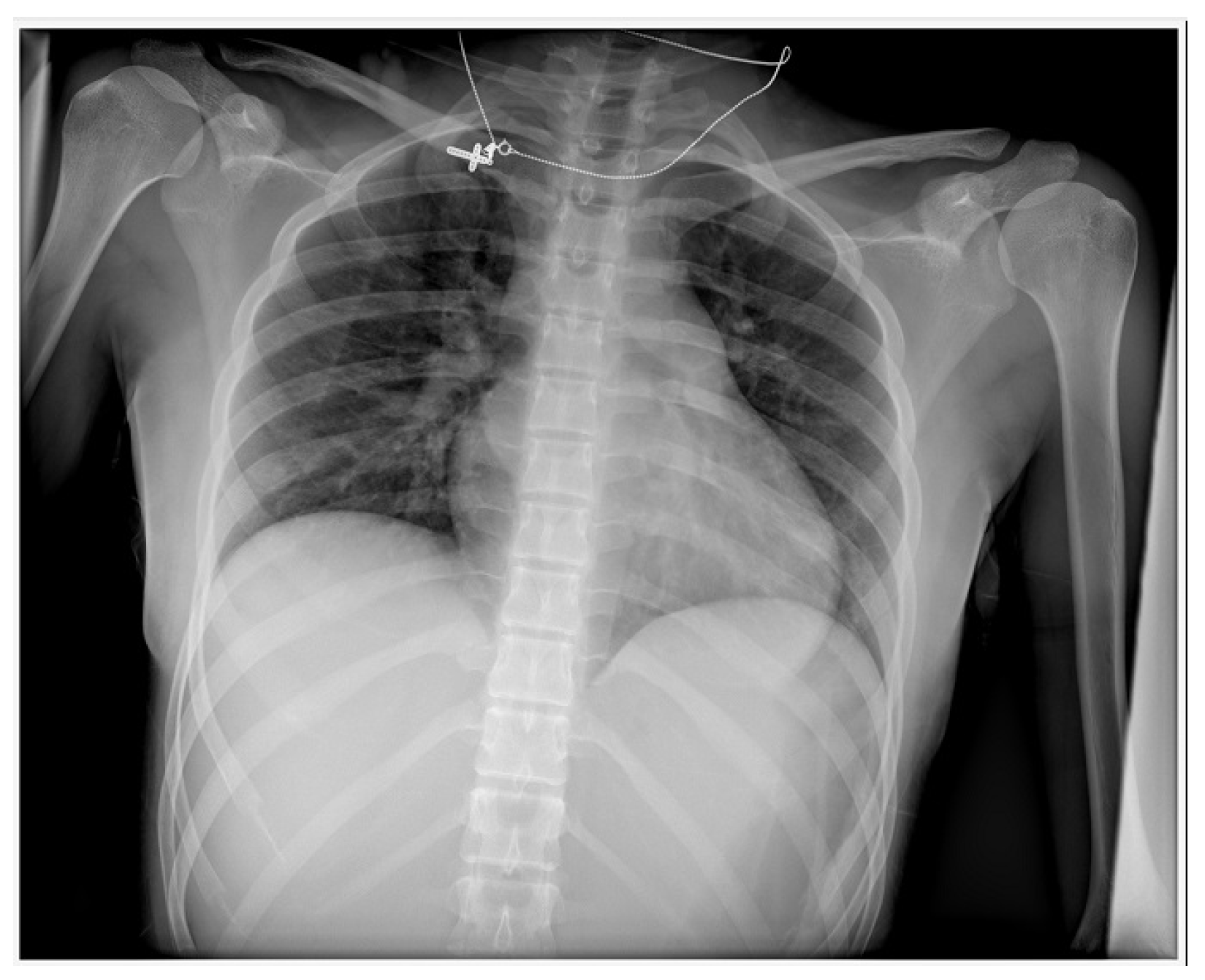 Vaccines 11 00956 g002